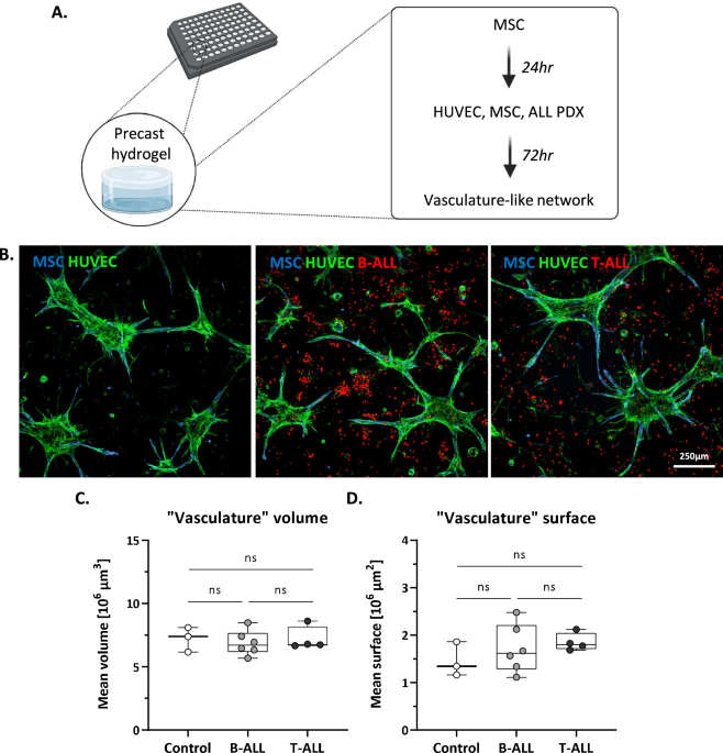 A three-dimensional ex vivo model recapitulates in vivo features and drug resistance phenotypes in childhood acute lymphoblastic leukemia