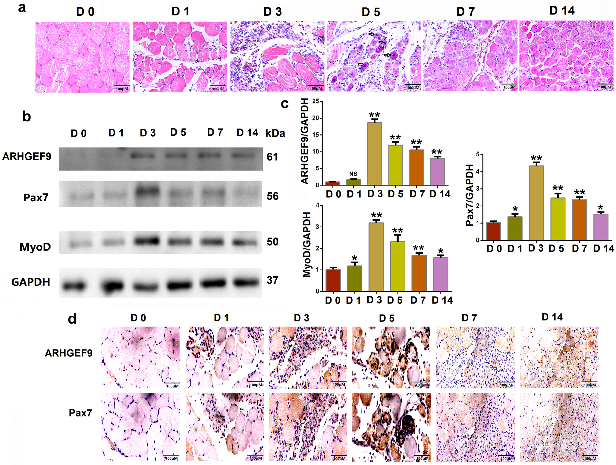 The influences of ARHGEF9 on myoblasts migration and differentiation