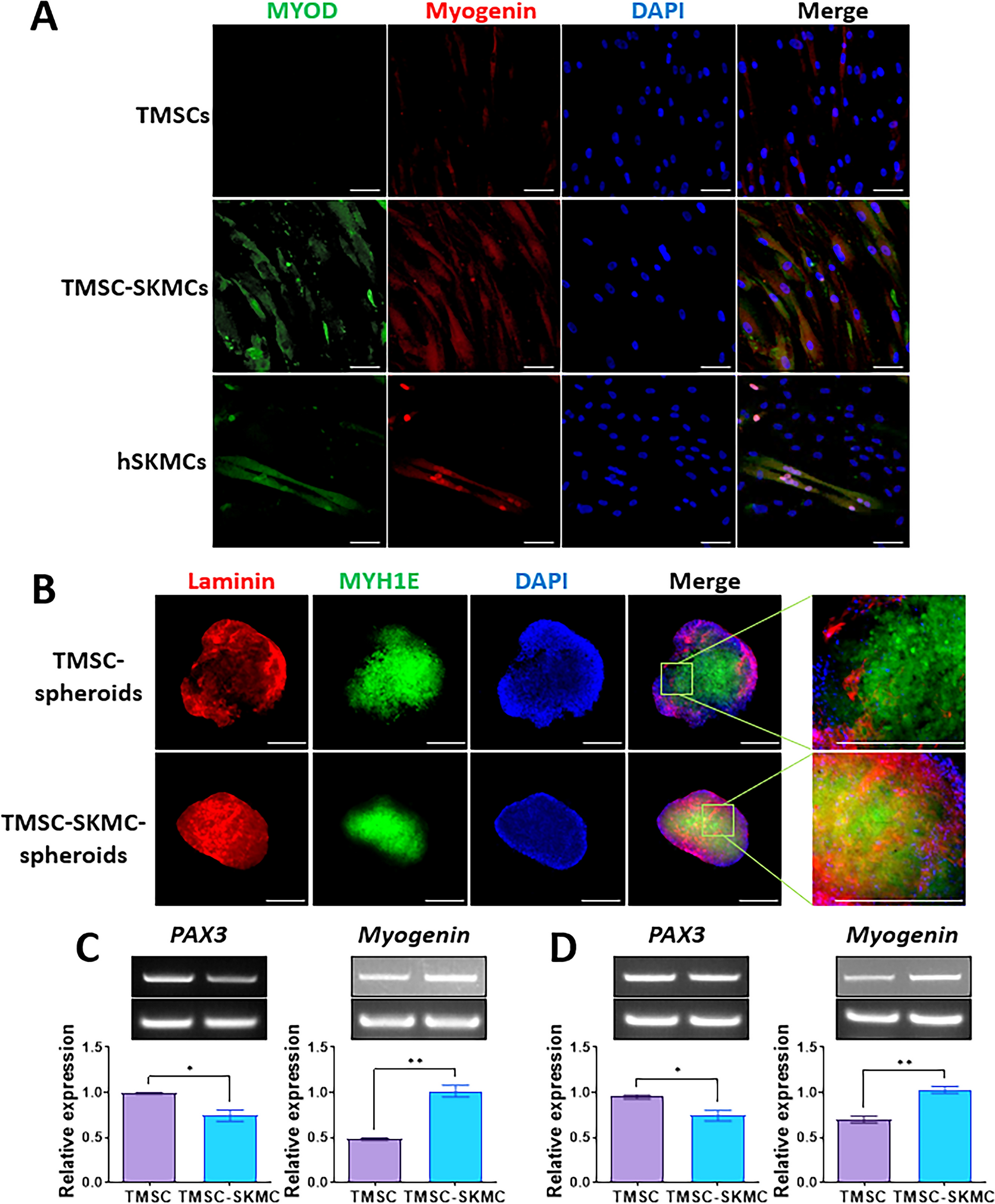 Human Mesenchymal Stem Cell-Derived Skeletal Muscle Cell Spheroids for Treating Dexamethasone-Induced Sarcopenia