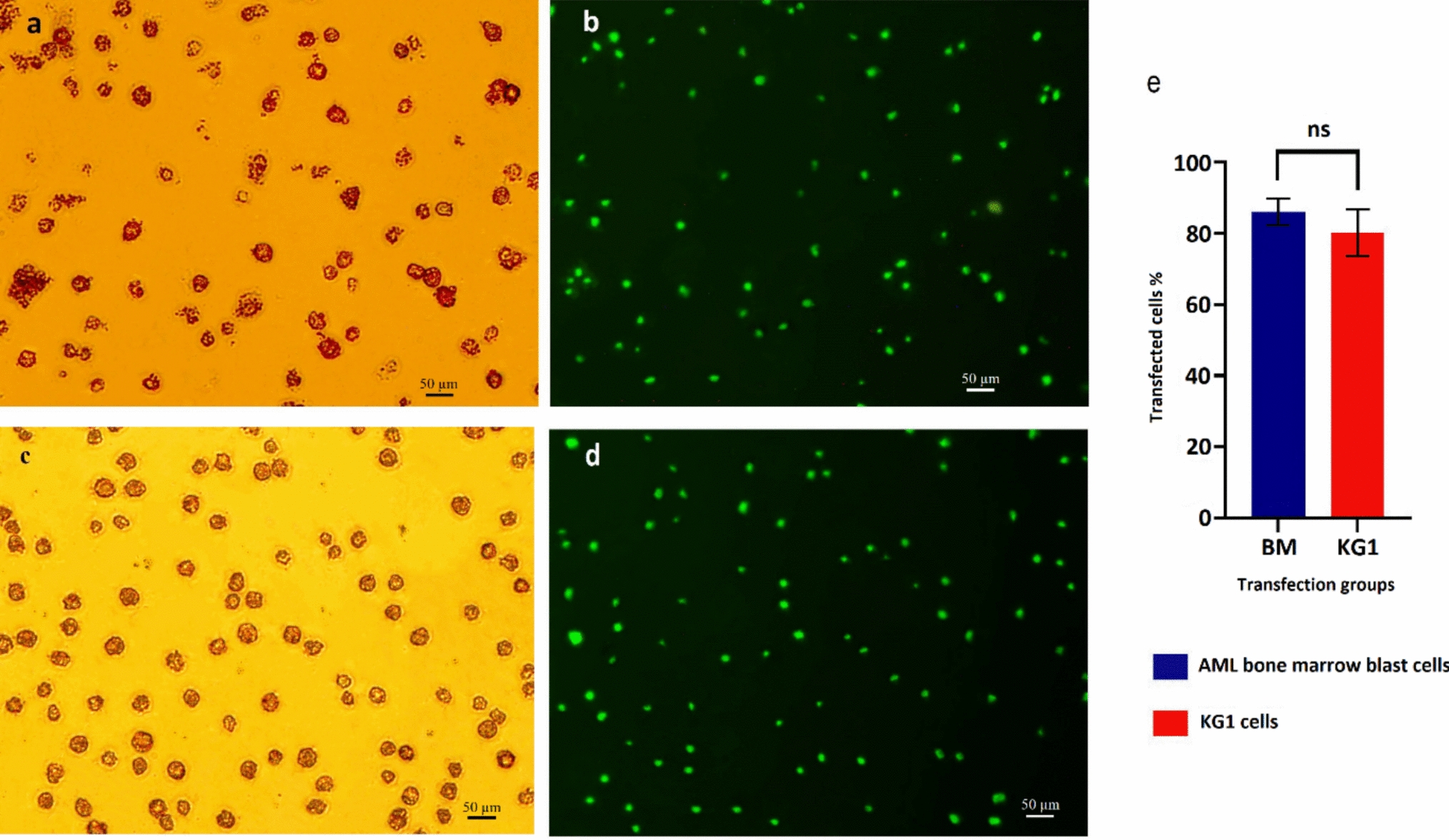 Antisense LNA GapmeR targeting hsa-piR-33195 induces antiproliferative and apoptotic effects on human acute myeloid leukemia
