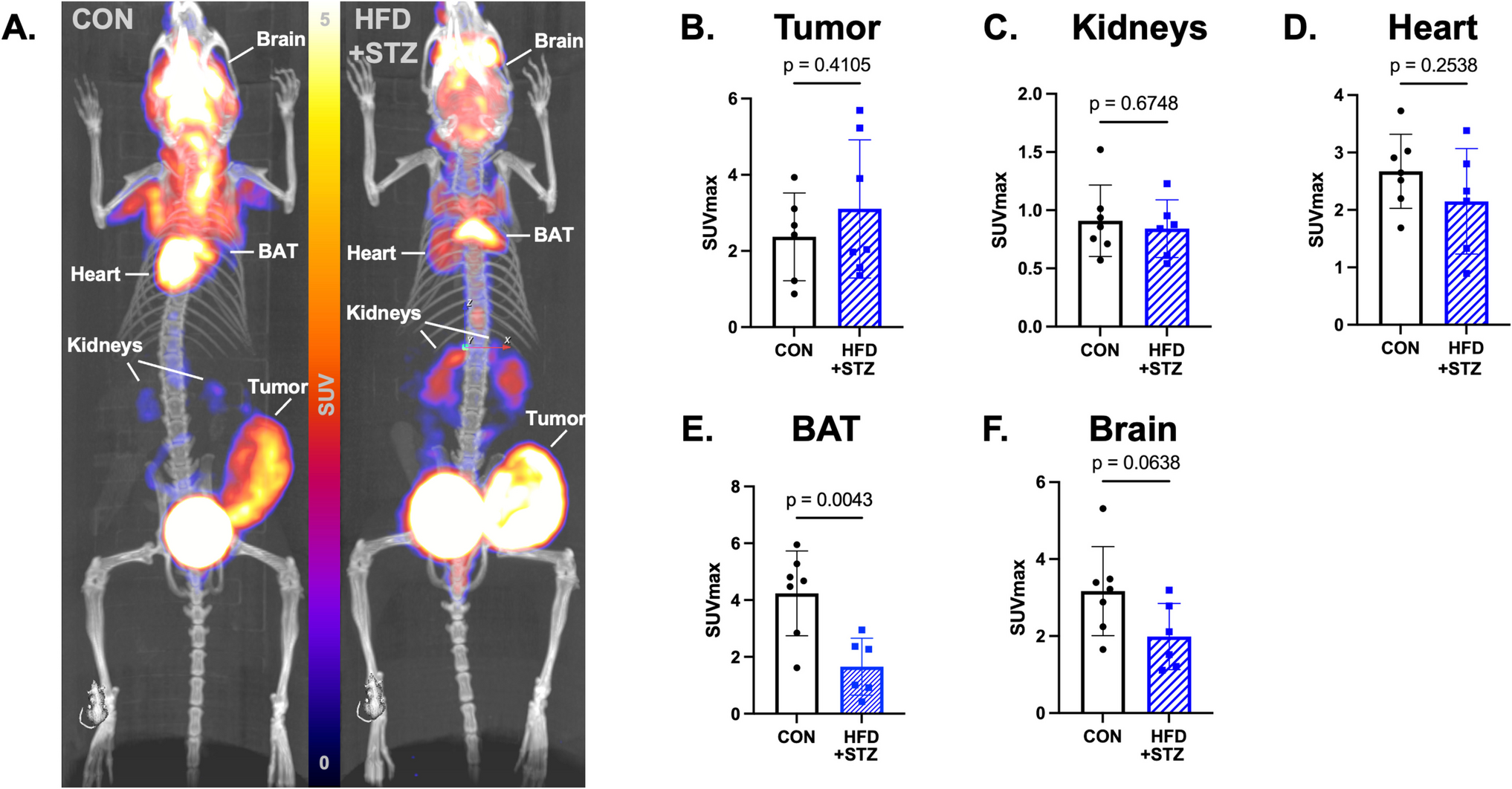 PET Imaging of Diabetes-Induced Alterations in Metabolism and Immune Activation