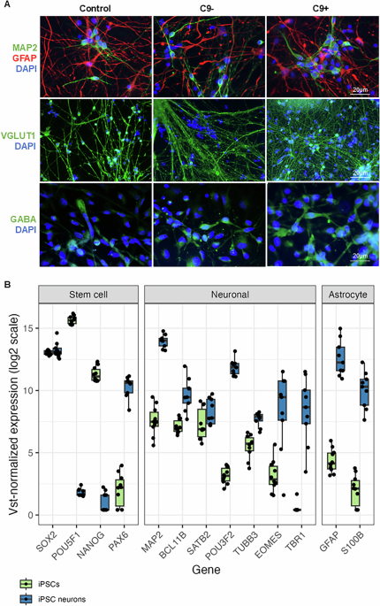 Frontotemporal dementia patient-derived iPSC neurons show cell pathological hallmarks and evidence for synaptic dysfunction and DNA damage