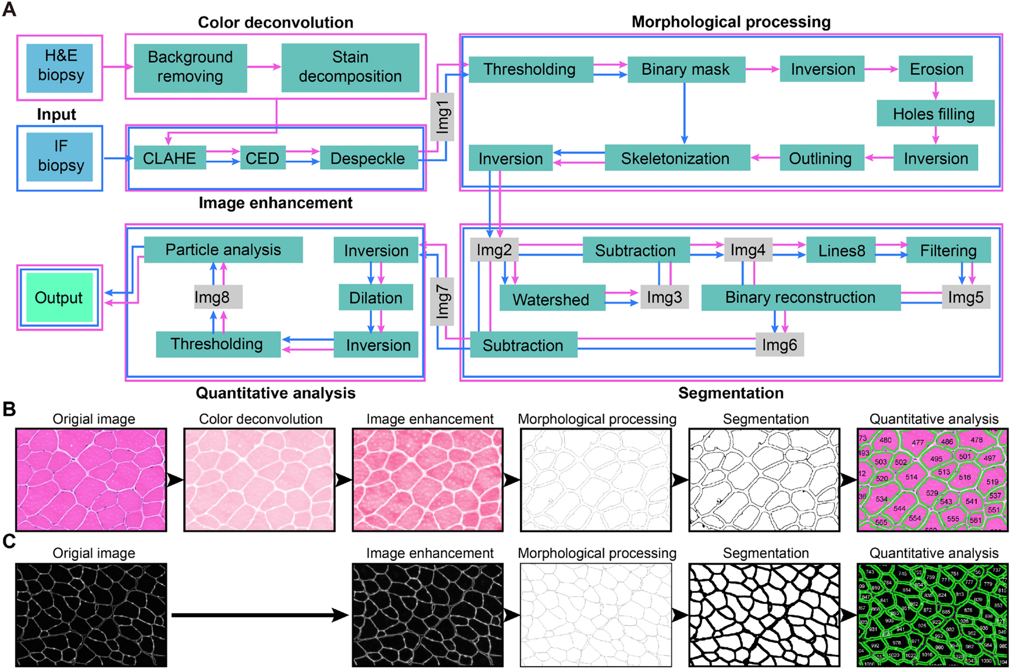 MyoAnalyst: an ImageJ plugin for accurate and automatic myofiber segmentation and analysis in skeletal muscle cross sections