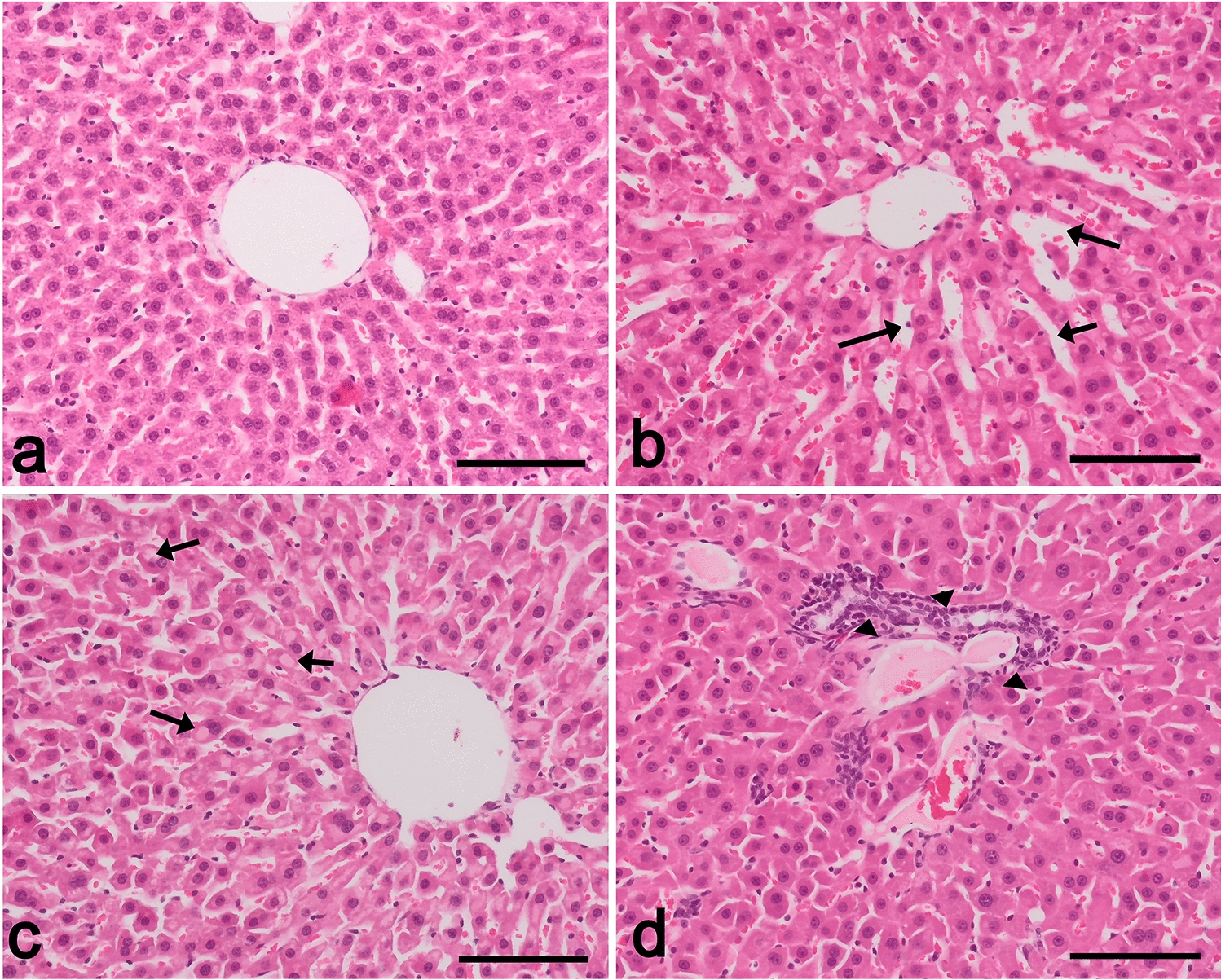 The first link between ADAMTS-13 and apoptosis in type 1 diabetic liver injury