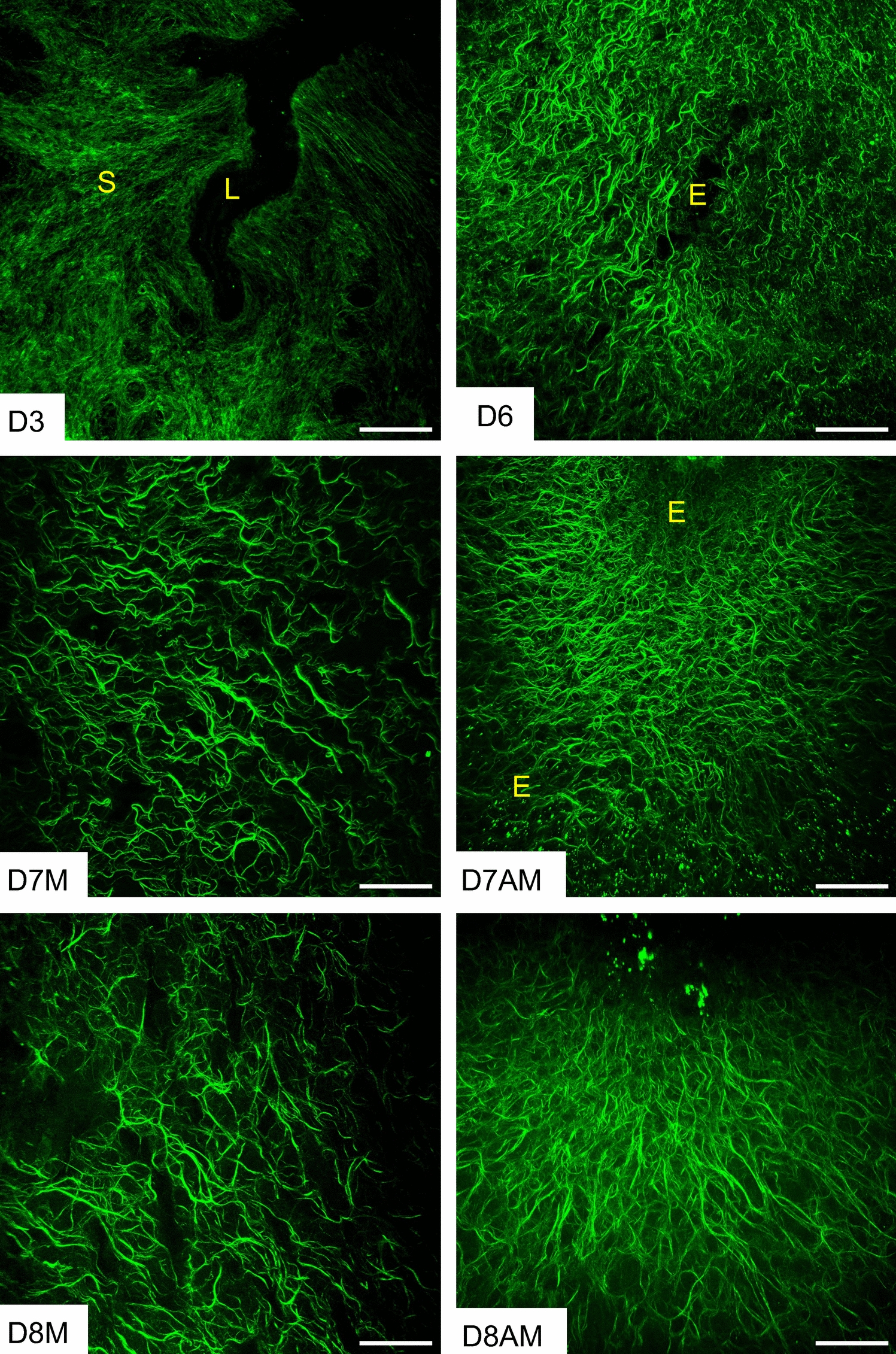 Extracellular matrix reorganization during endometrial decidualization