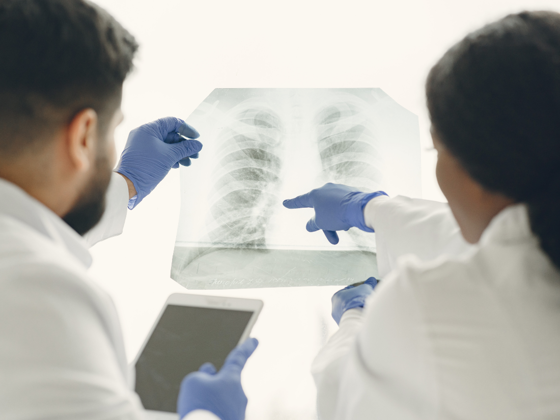 Impact of Immune Checkpoint Inhibitors on Second Primary Cancer Risk in Patients With Metastatic Lung Cancer Using Real-World Data From the TriNetX Network: Retrospective Cohort Study