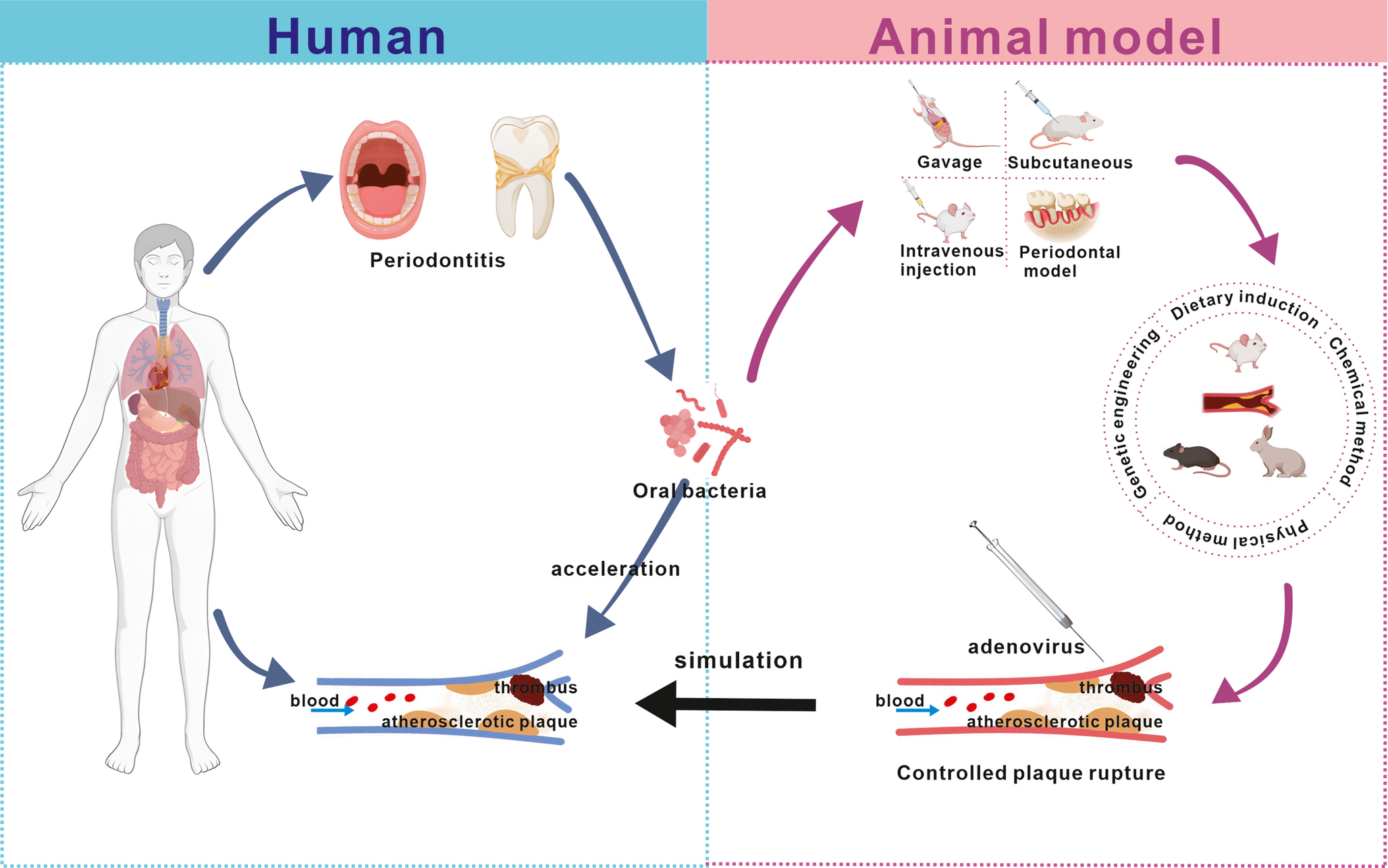 Correlation Between Oral Bacteria and Atherosclerotic Thrombotic Disease: Advances in Animal Model Studies