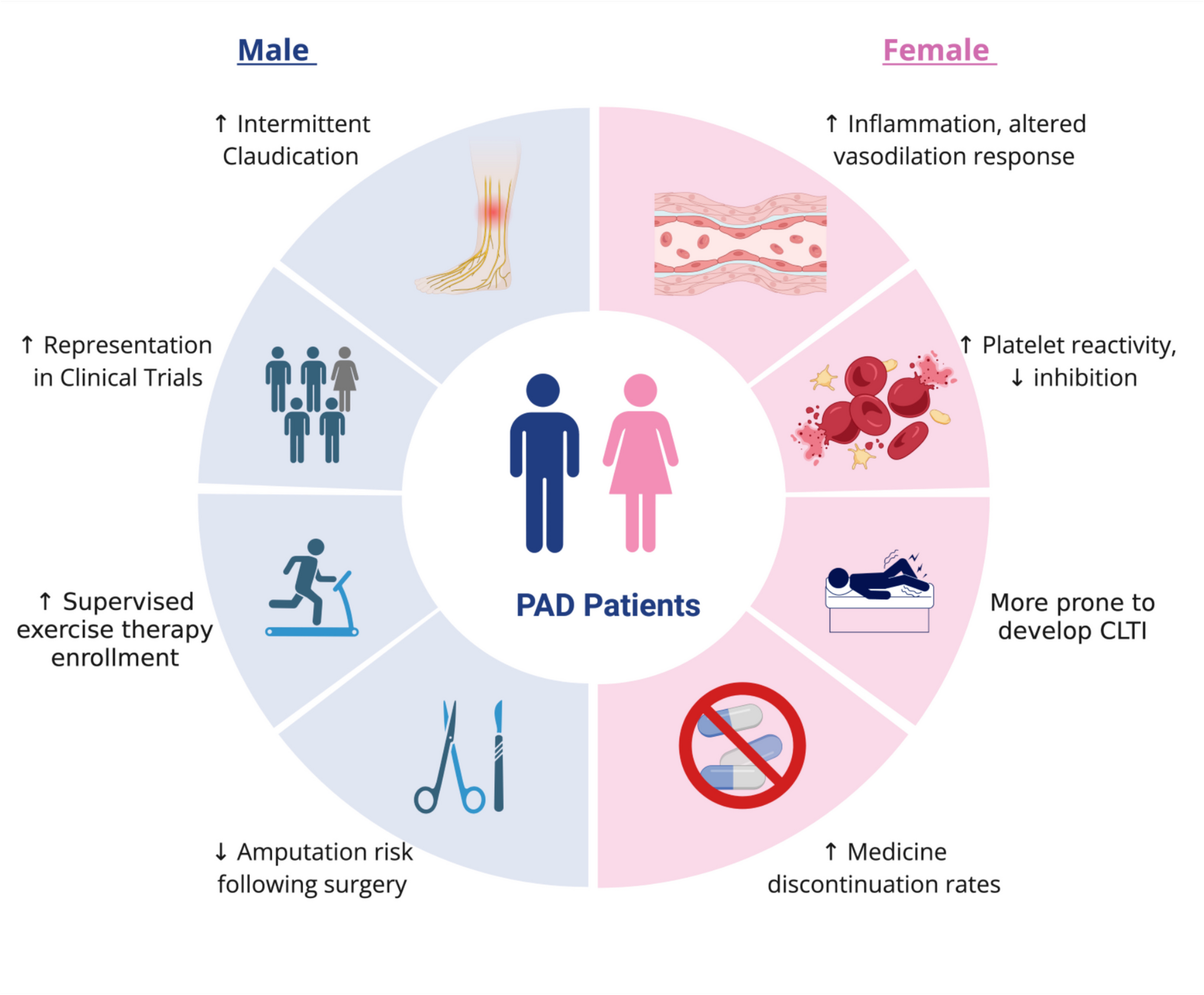 Unveiling the Sex-Based Divide: Exploring Sex Differences in Peripheral Artery Disease