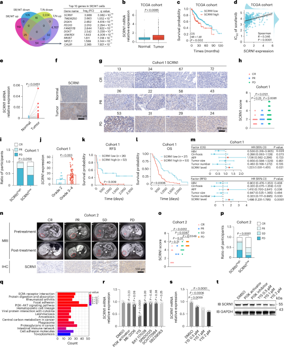 SCRN1 confers hepatocellular carcinoma resistance to ferroptosis by stabilizing GPX4 via STK38-mediated phosphorylation
