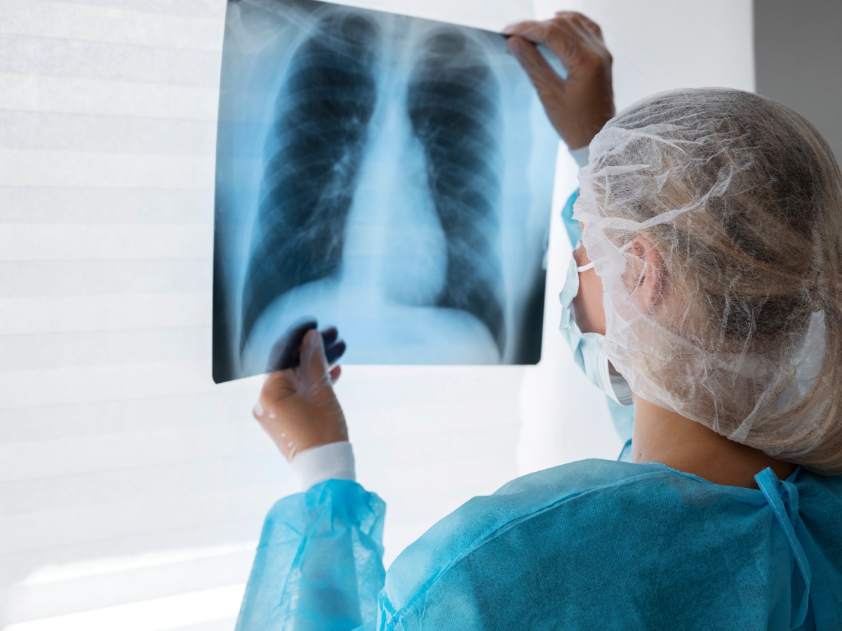 Implementation, Experiences, Impact, and Costs of Artificial Intelligence in Chest Diagnostics: Protocol for a Mixed Methods Evaluation
