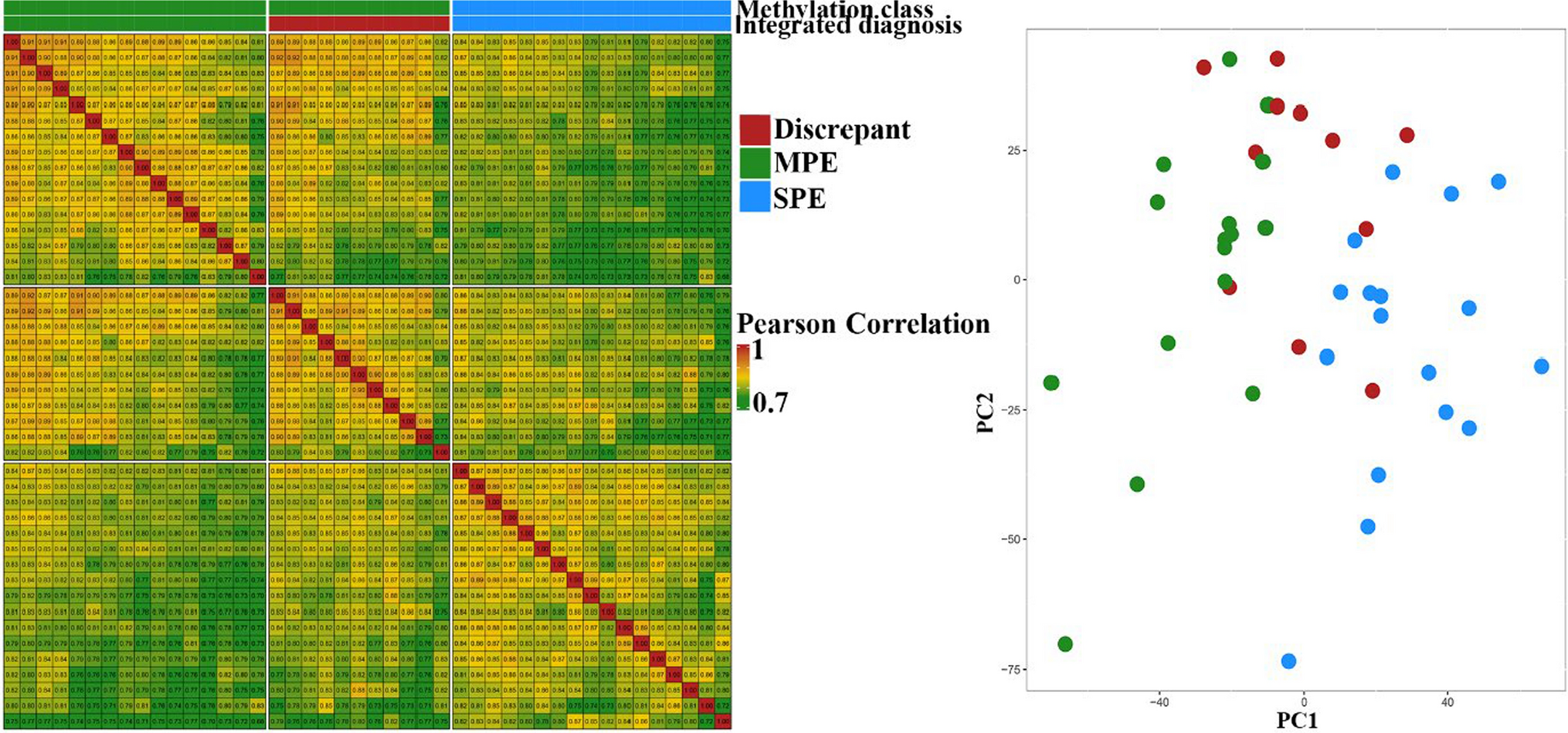 Expansion of the spectrum of tumors diagnosed as myxopapillary ependymomas