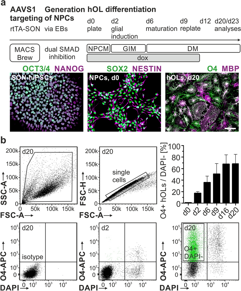 Alpha synuclein-mediated cytoskeletal dysfunction impairs myelination in human oligodendrocytes