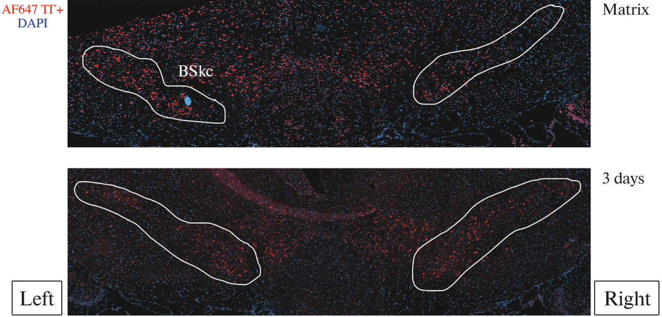 Partial Restoration of the Number of Dopaminergic Neurons in the Substantia Nigra in Mice with the Mptp Model of Parkinson’s Disease by Introducing a Microgel Based on Recombinant Spidroin rS1/9