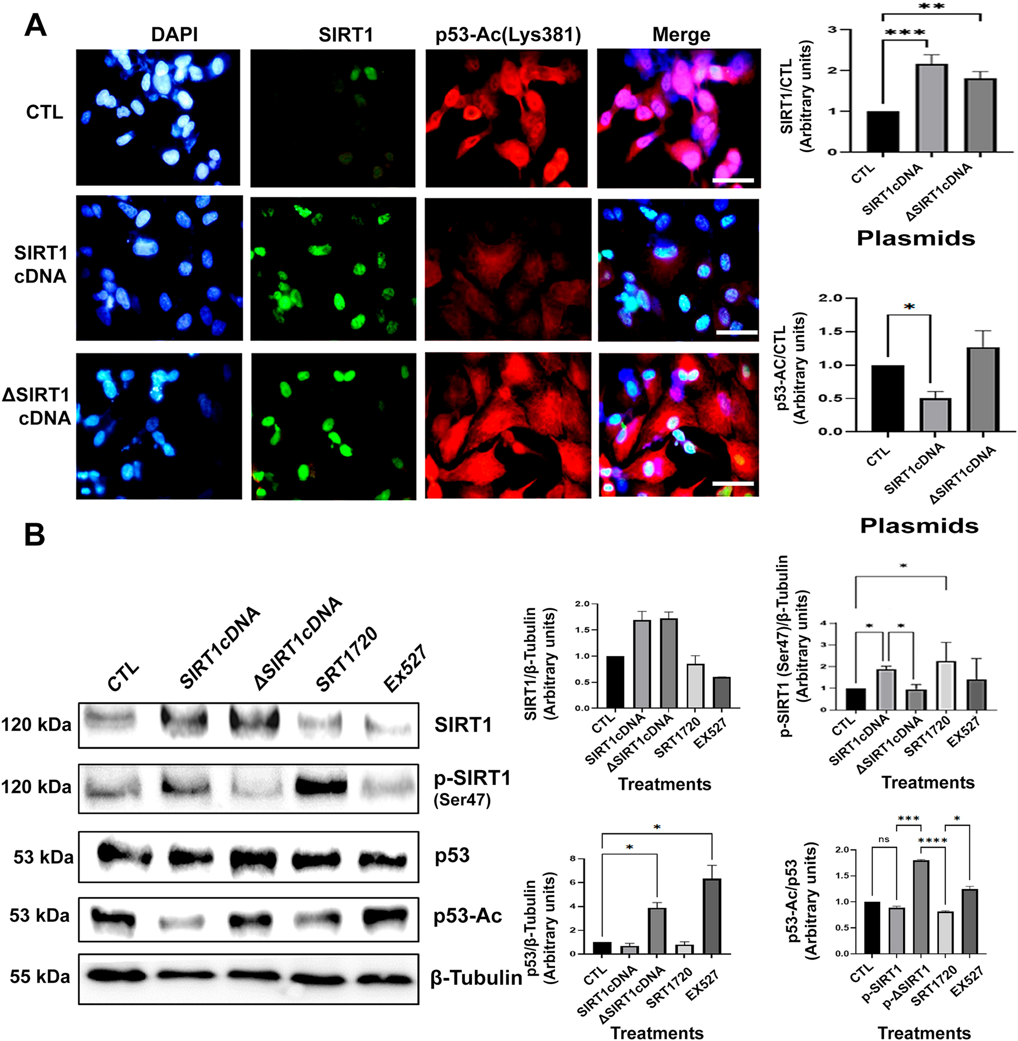 Epigenetic regulation of histone 3 acetylation and p53 by SIRT1 overexpression in an experimental model of alveolar epithelium damage