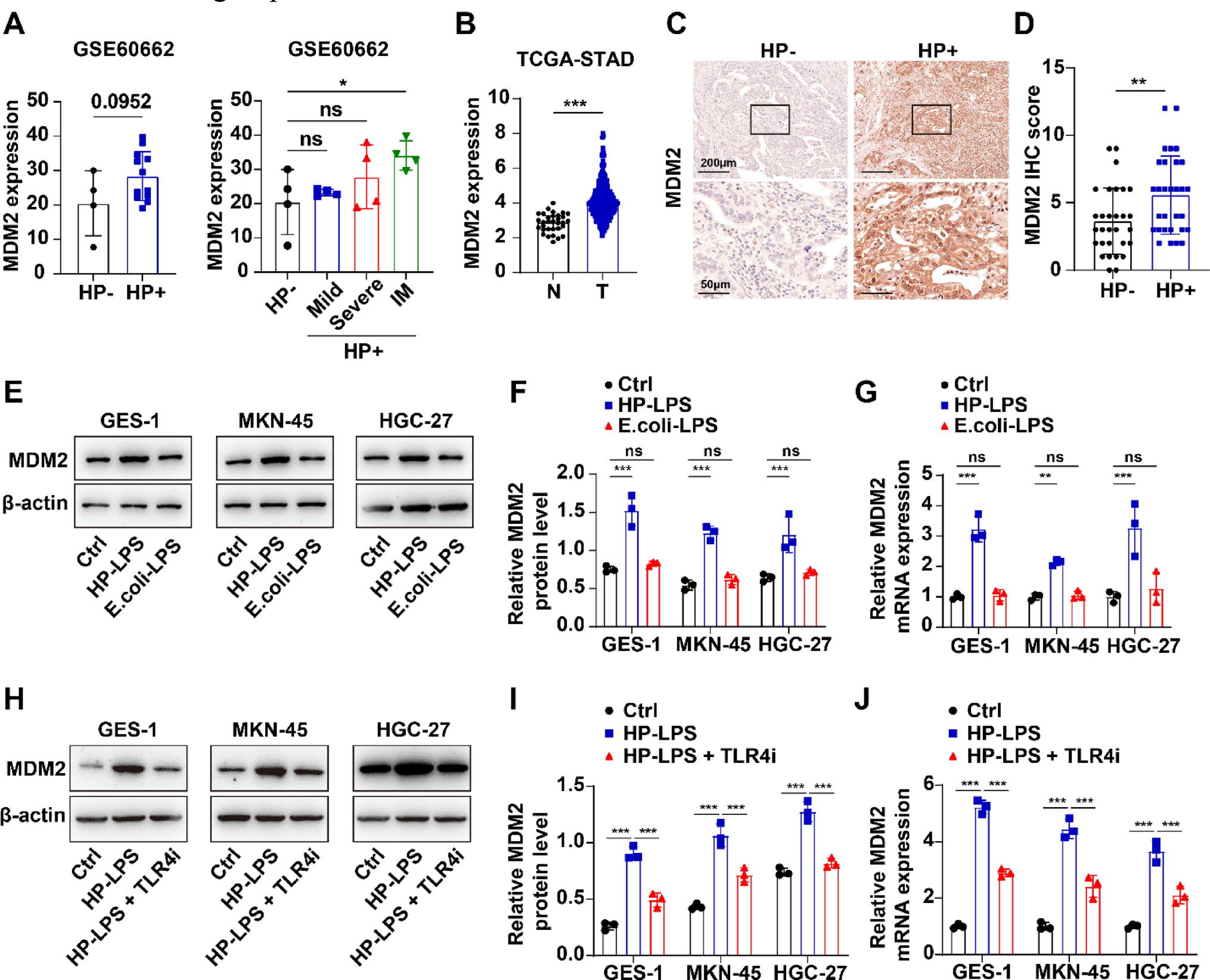 Lipopolysaccharide Upregulates MDM2 via the TLR4/MAPK/AP-1 Pathway to Promote Gastric Cancer Progression