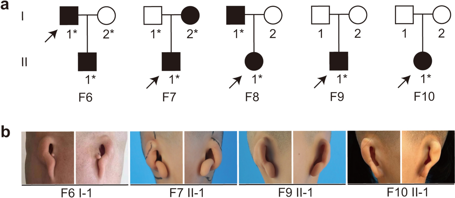 Non-recurrent duplications on chromosome 4p16.1 involving cis-regulatory elements affecting neural crest development in patients with isolated bilateral microtia