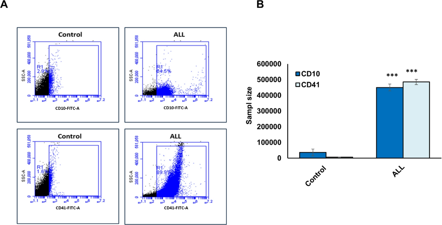 Hypermethylation of lysosomal-associated genes  and  compromises lysosome function in patients with acute lymphoblastic leukemia