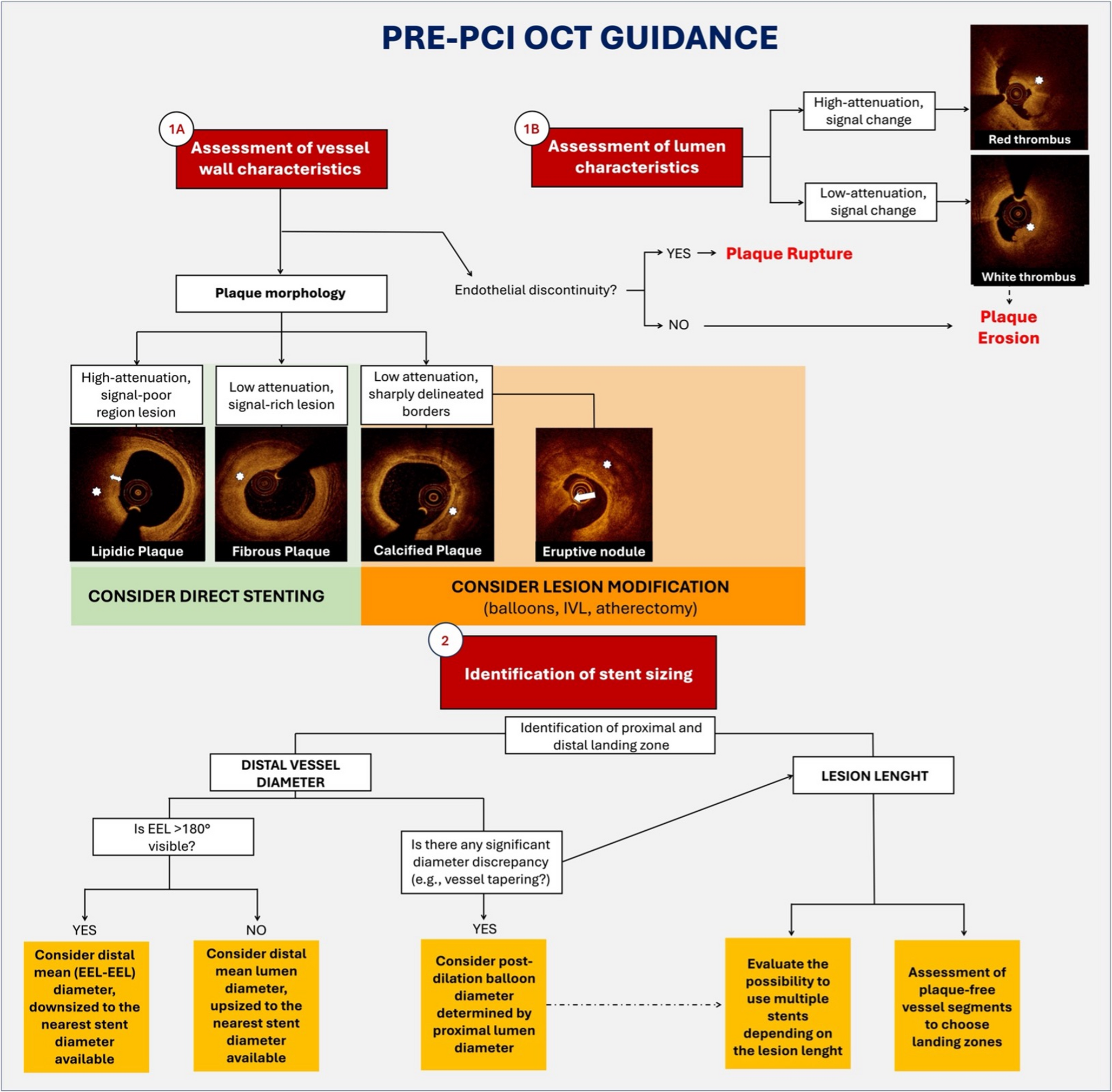 Optical Coherence Tomography Essentials for Percutaneous Coronary Intervention Guidance