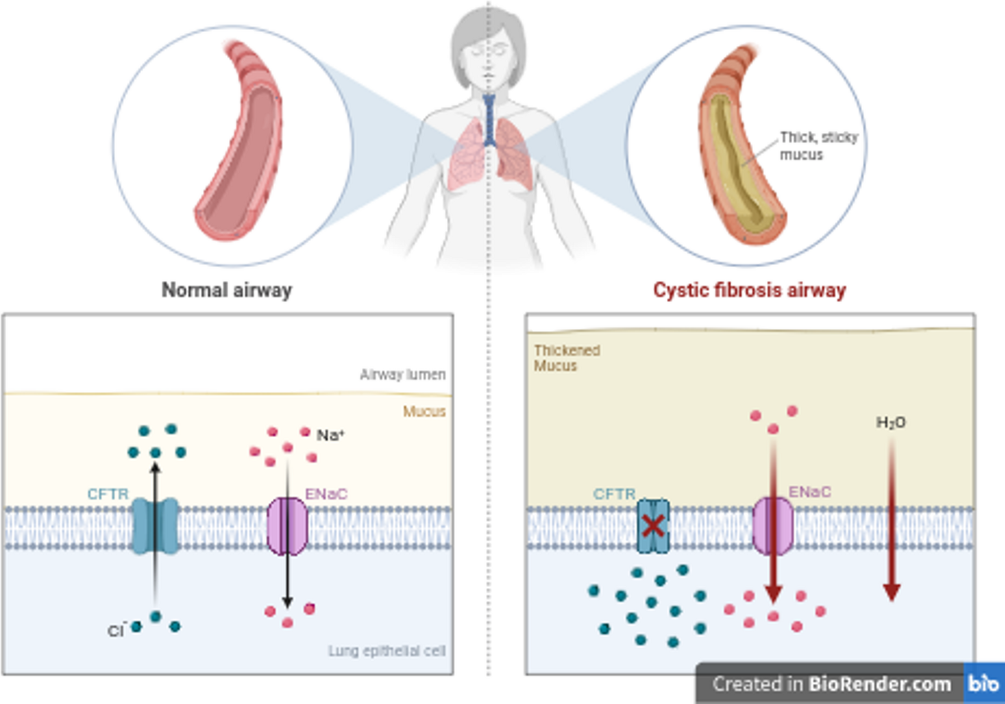 Modulator Therapy: A Narrative Review of the Triple Combination of Tezacaftor, Elexacaftor, and Ivacaftor in the Management of Cystic Fibrosis