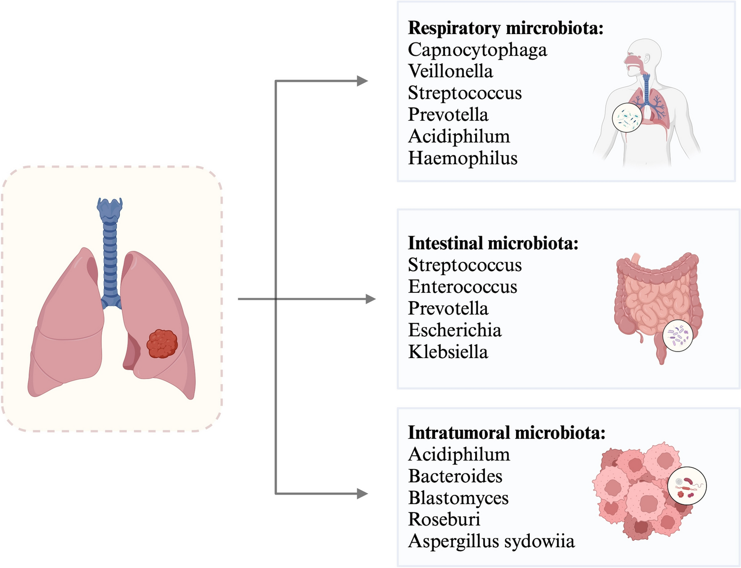 Microflora: a promising potential in the diagnosis and treatment of non-small cell lung cancer