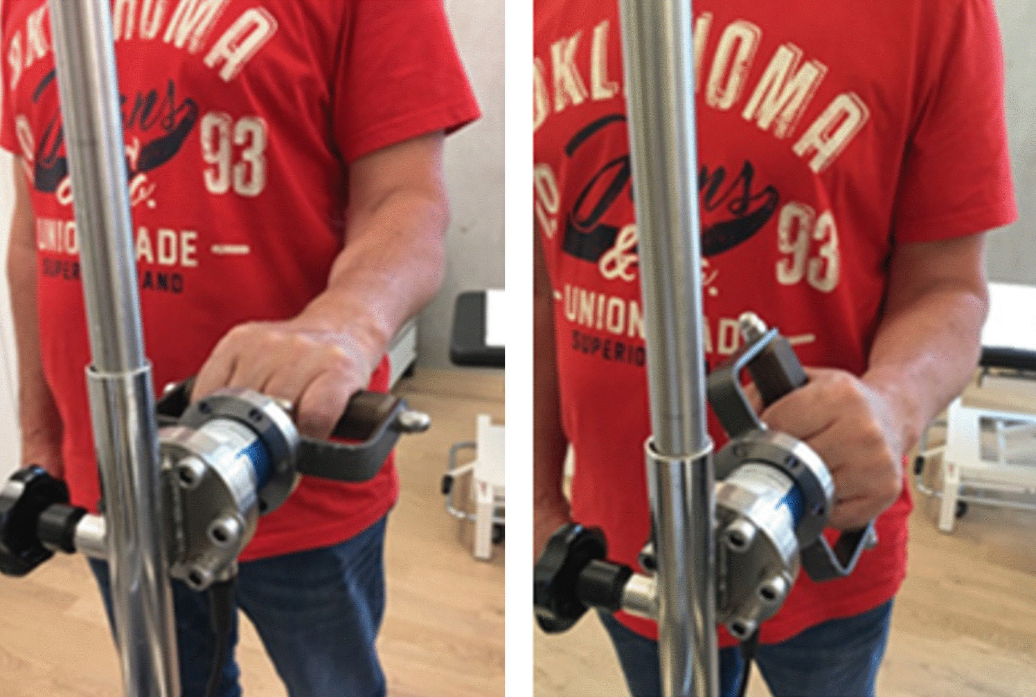 Conservative versus operative treatment of distal biceps tendon ruptures in young and active patients