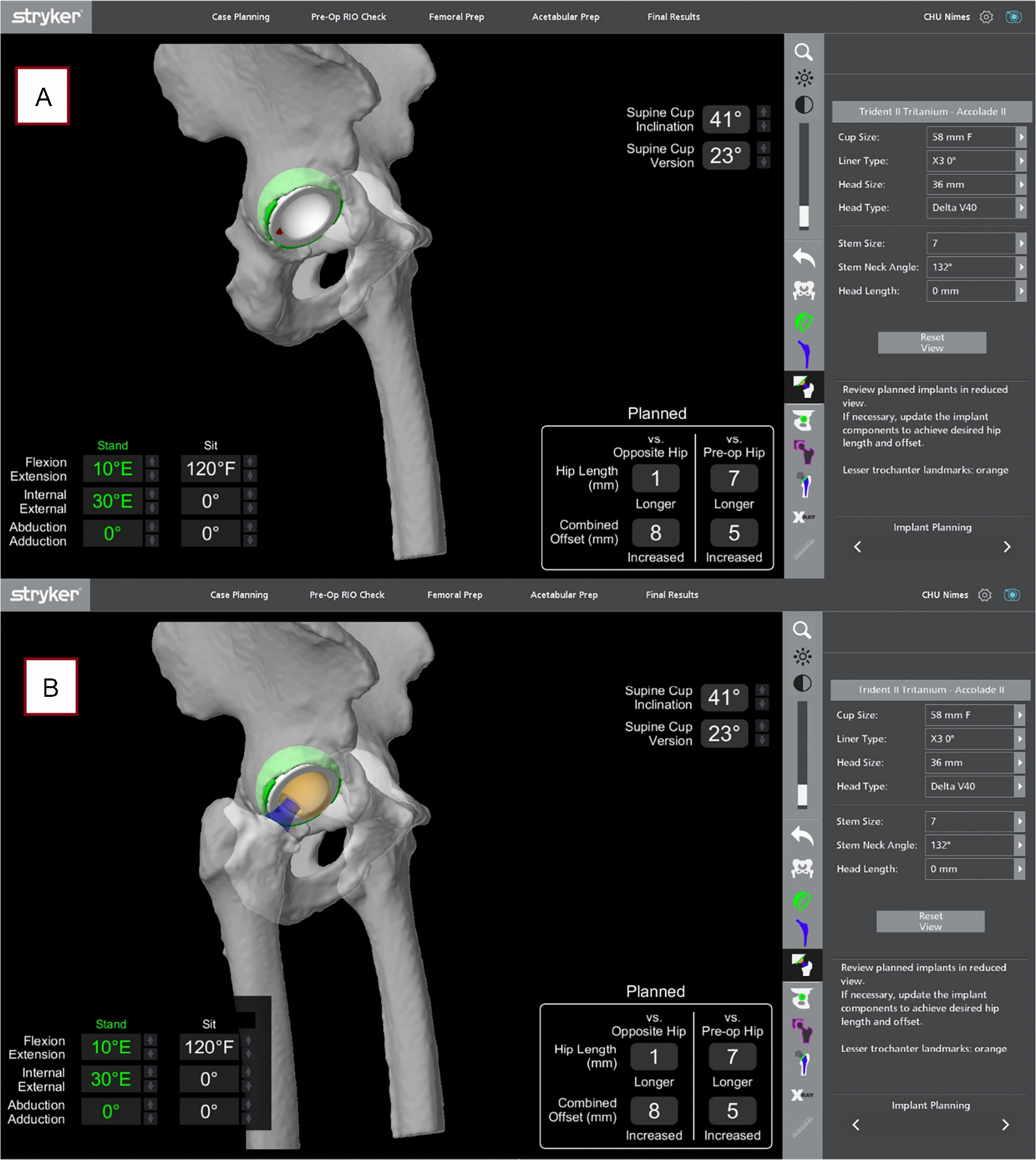 Beyond jump distance: modular dual mobility versus single mobility cups in robotic total hip arthroplasty - simulation of hip kinematics and impingement