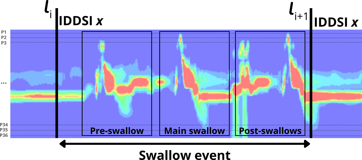 Multimodal framework for swallow detection in video-fluoroscopic swallow studies using manometric pressure distributions from dysphagic patients
