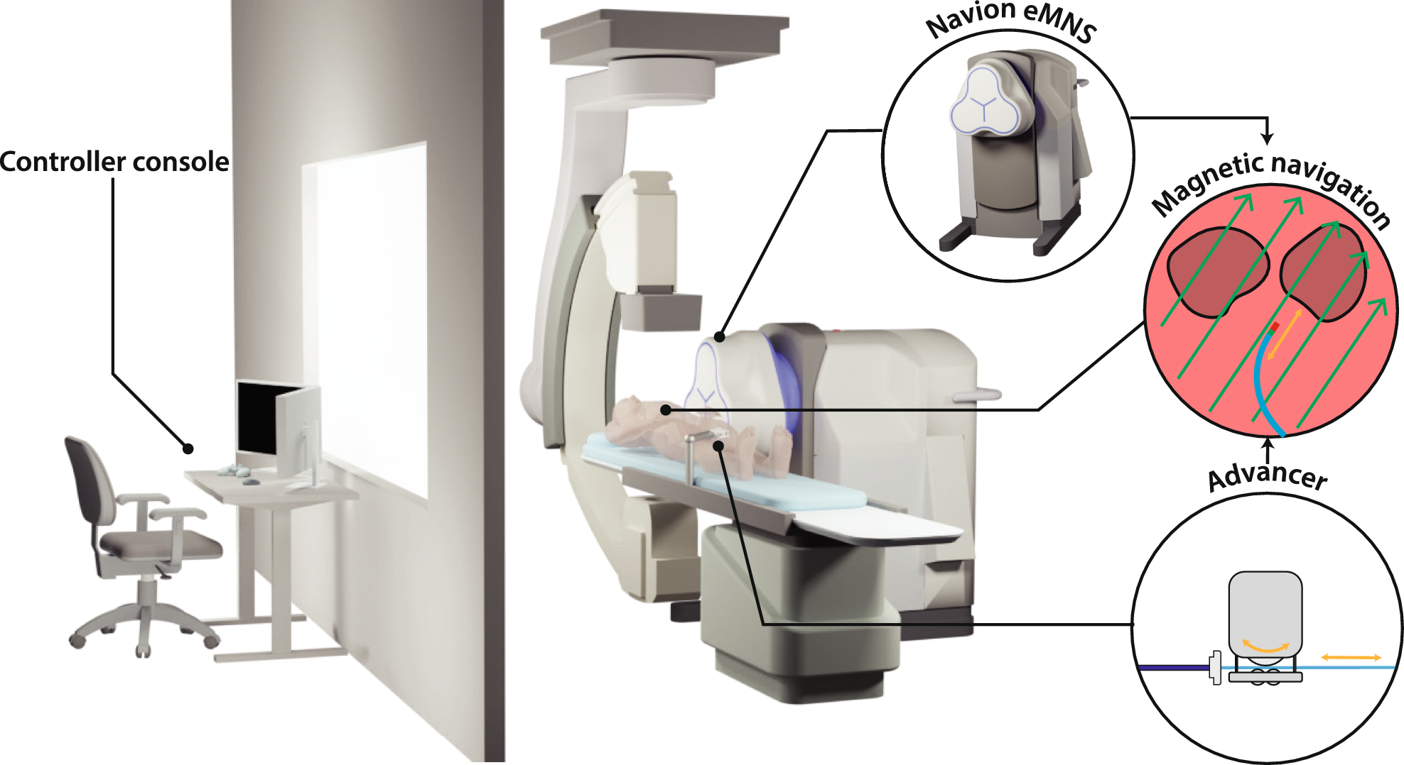Investigating workload and usability of remote magnetic navigation for catheter ablation