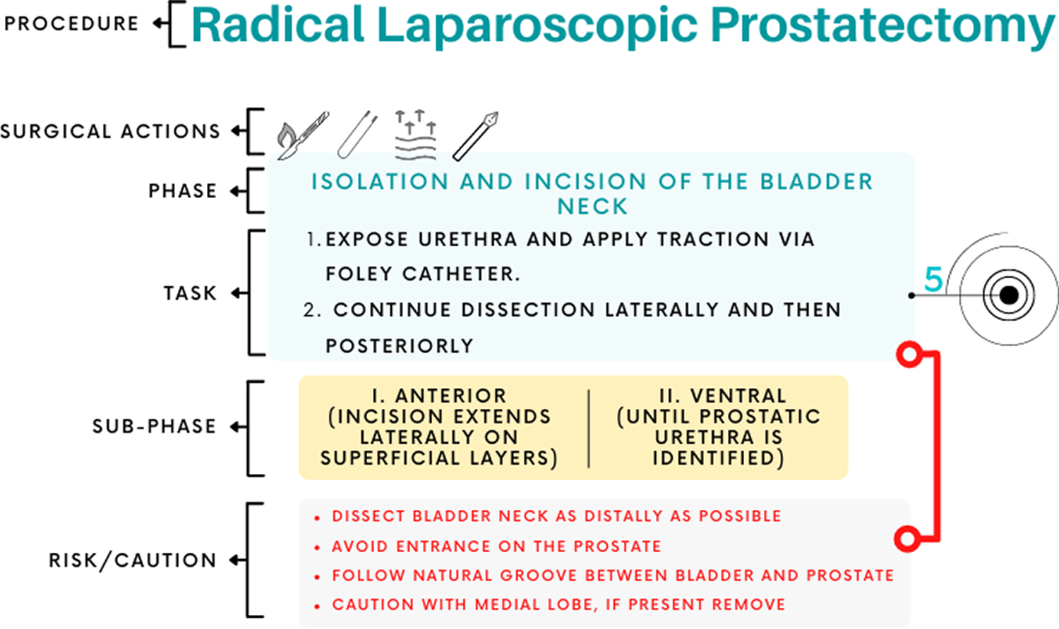 In-depth characterization of a laparoscopic radical prostatectomy procedure based on surgical process modeling