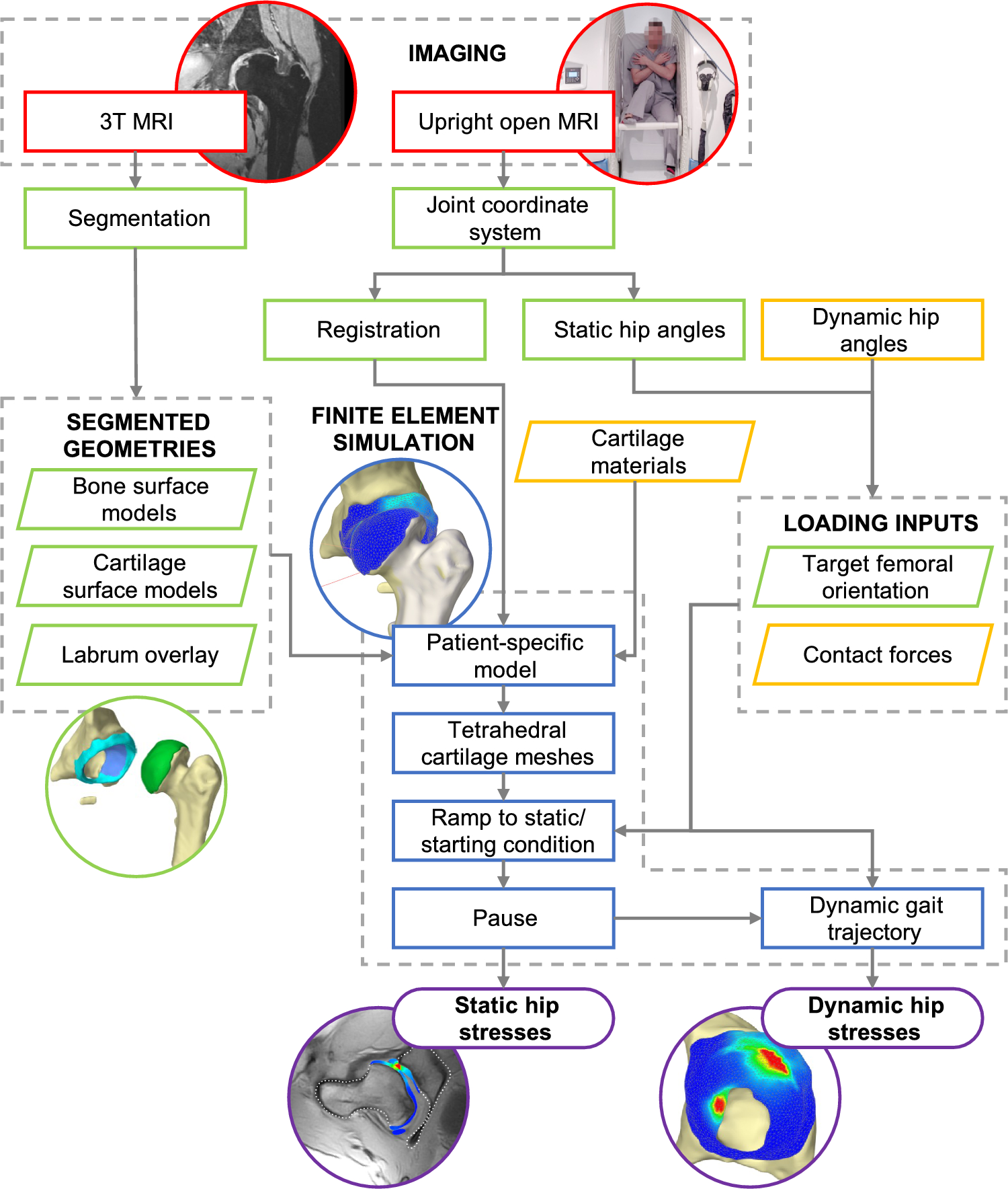 A biomechanical digital twin of Legg–Calvé–Perthes disease deformity