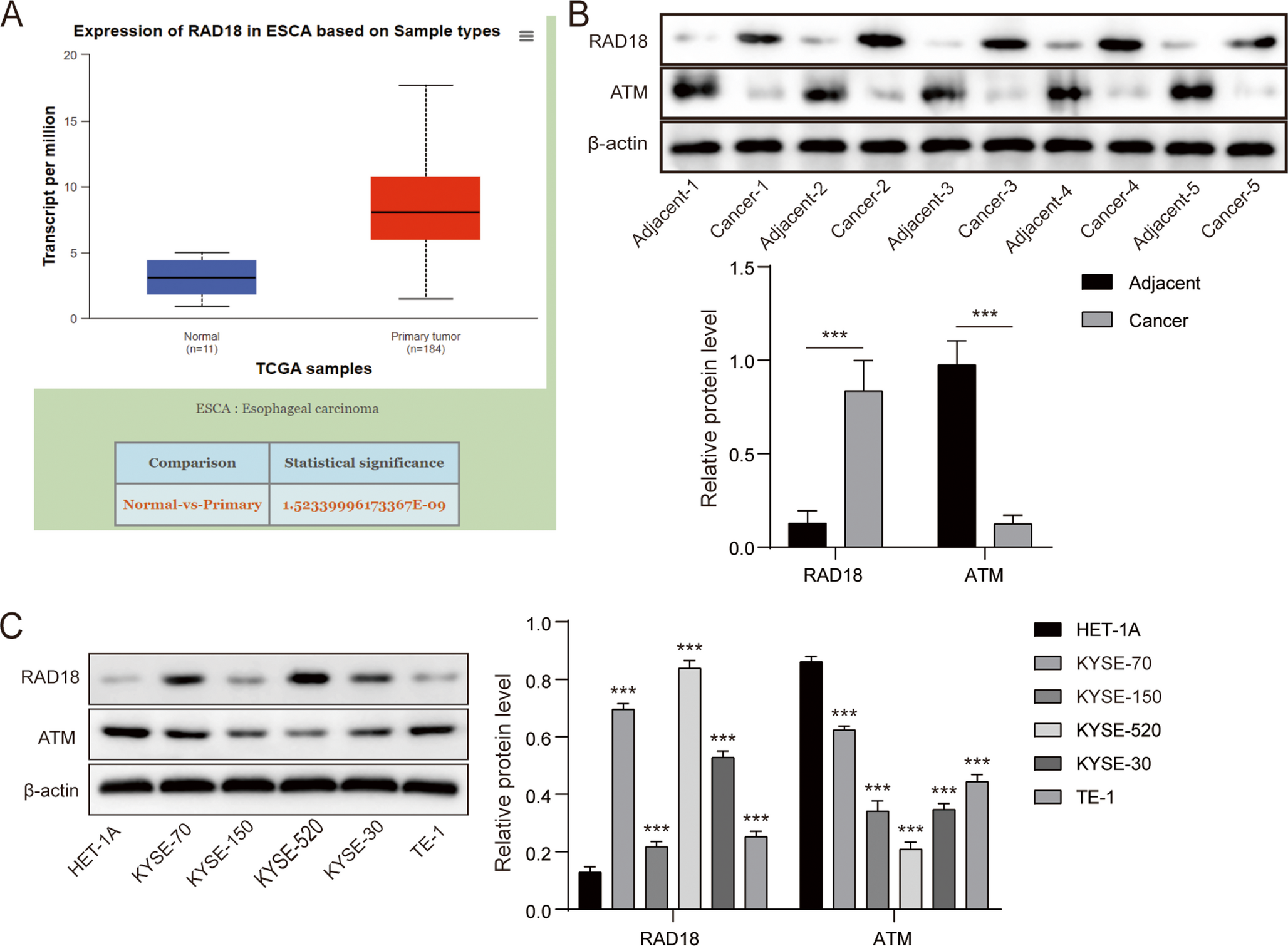 RAD18 promotes cell malignant behaviors of esophageal squamous cell carcinoma by modulating ATM/STAT3/PD-L1