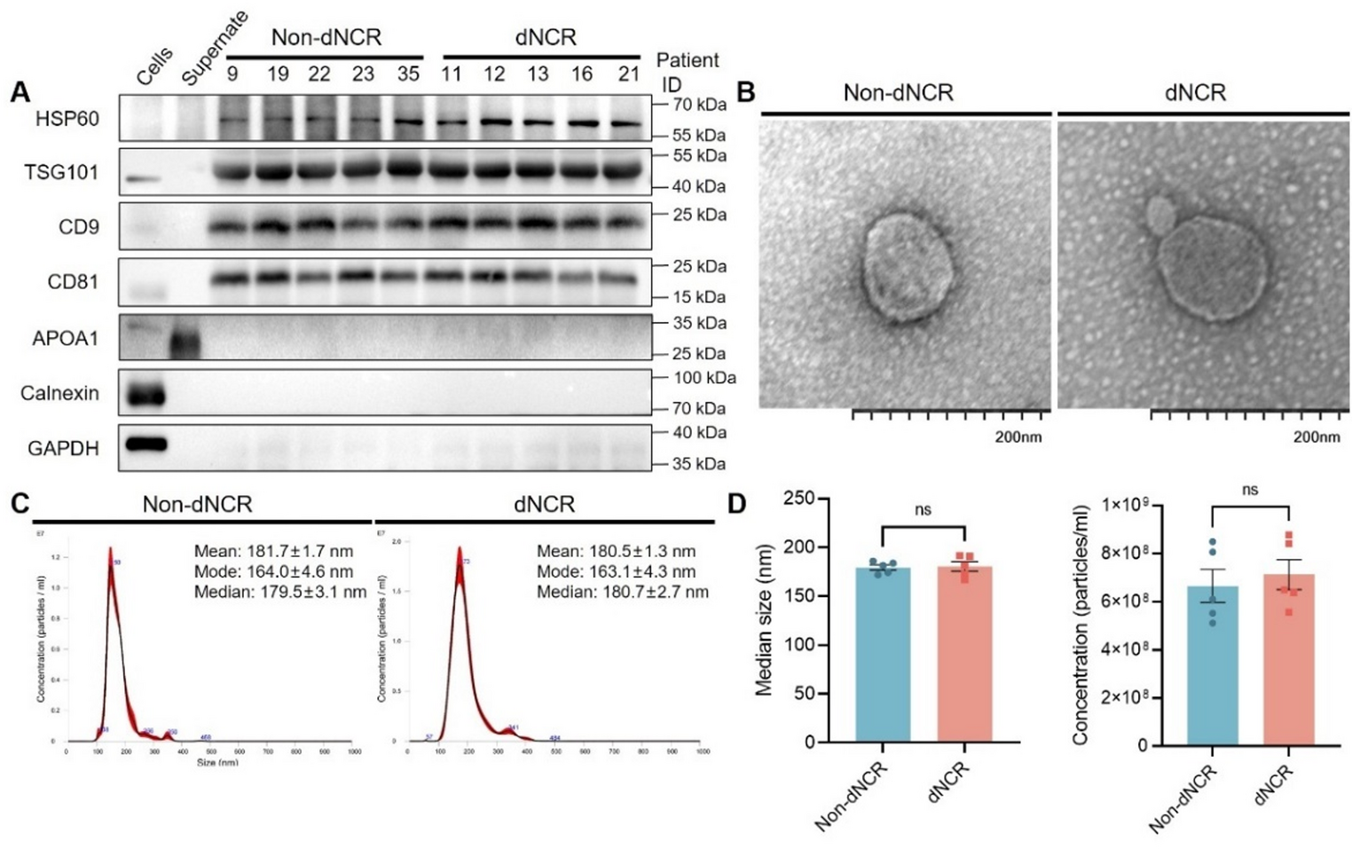 Plasma-Derived Exosomal hsa-miR-3677-3p Induces Ferroptosis in Neurons by Targeting  in Perioperative Neurocognitive Disorders After Prostate Surgery