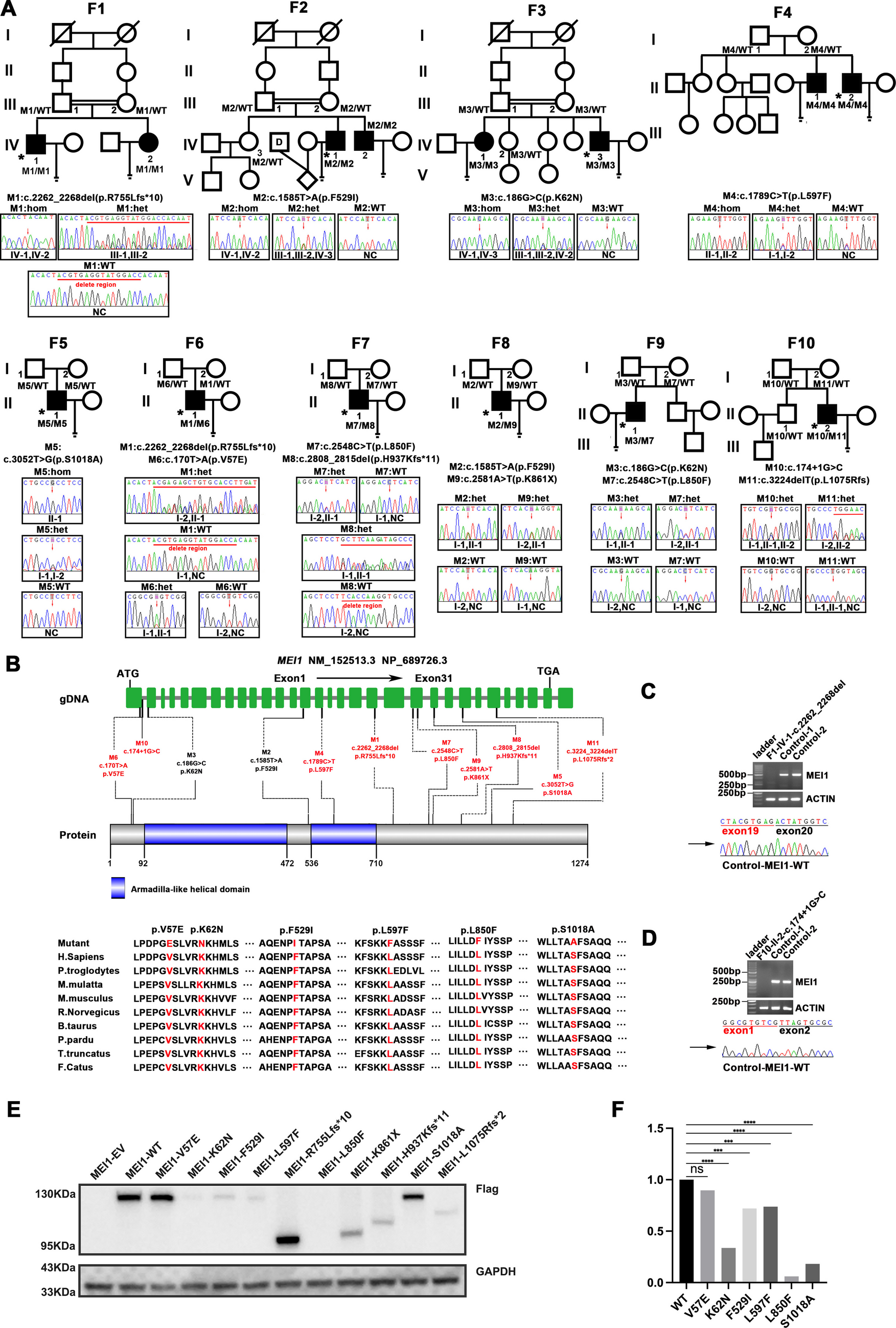 A common cause of non-obstructive azoospermia: biallelic  variants and implications for infertility diagnostics