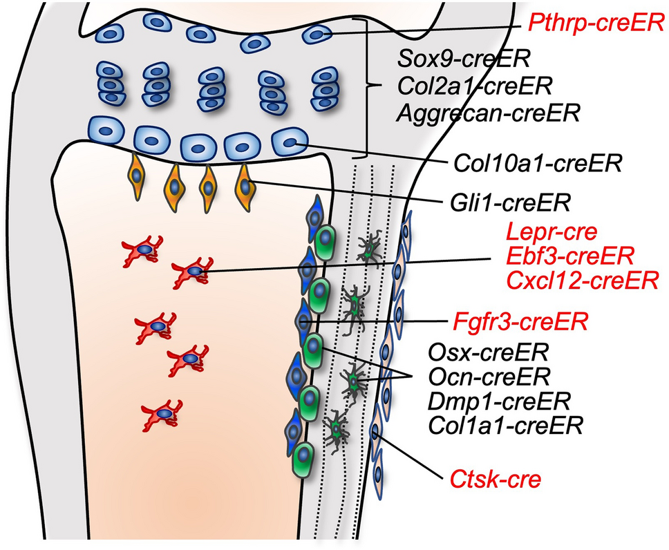 Skeletal stem cell lineages in osteosarcoma and bone metastasis