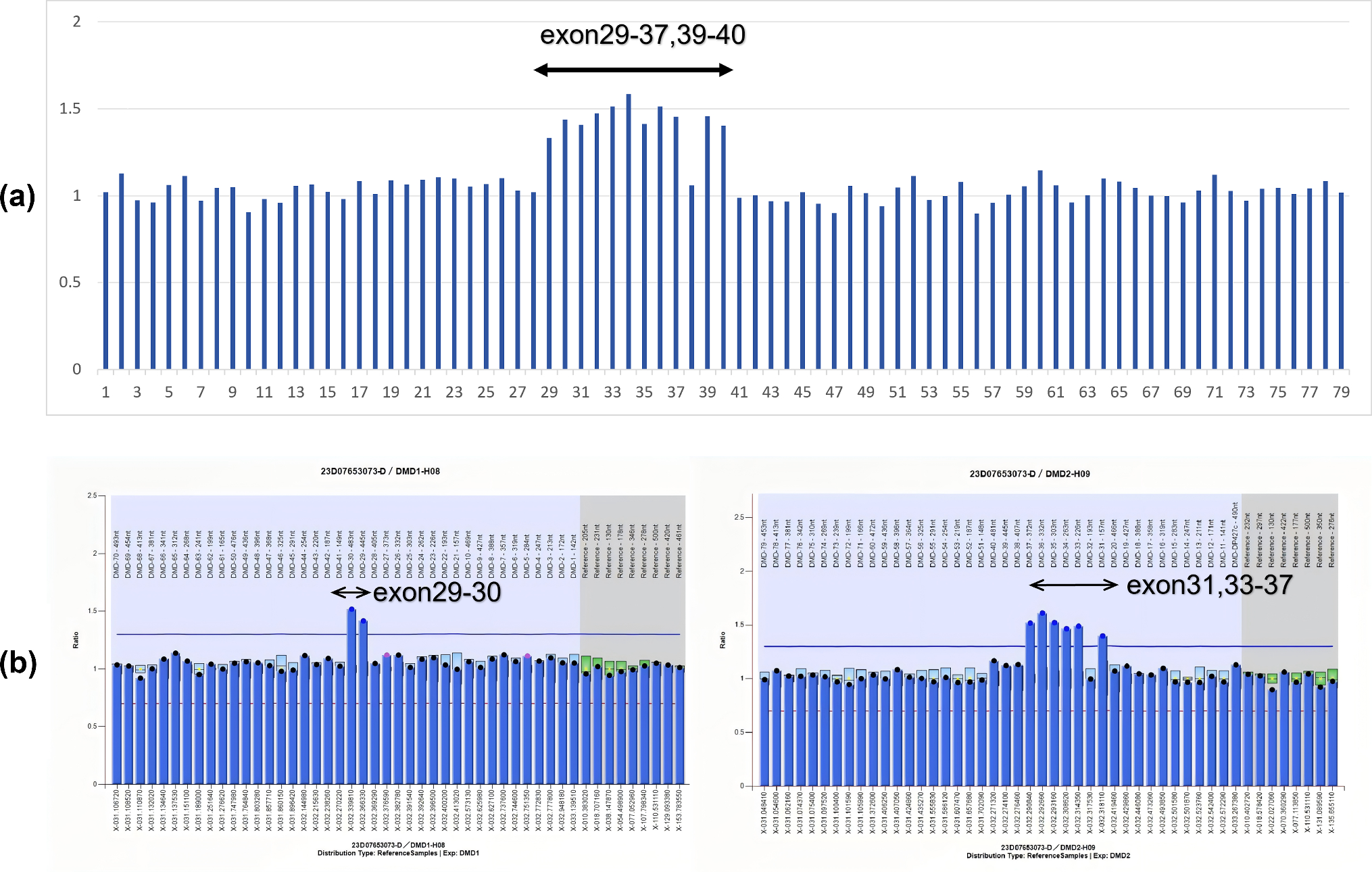 A novel partial mRNA-derived duplication of the  gene identified in NGS carrier screening