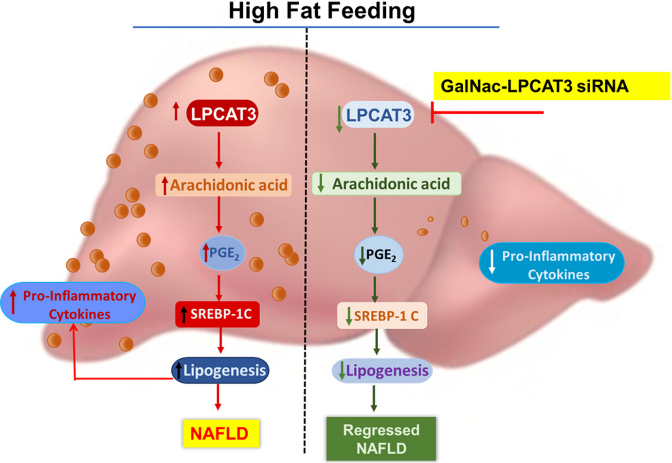 Liver specific-inhibition of LPCAT3 ameliorates metabolic dysfunction-associated steatotic liver disease
