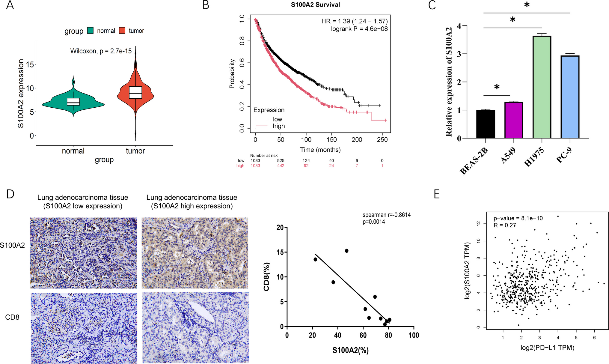 E2F7 targets S100A2 to suppress CD8T cell activity in lung adenocarcinoma by regulating glutamine metabolism
