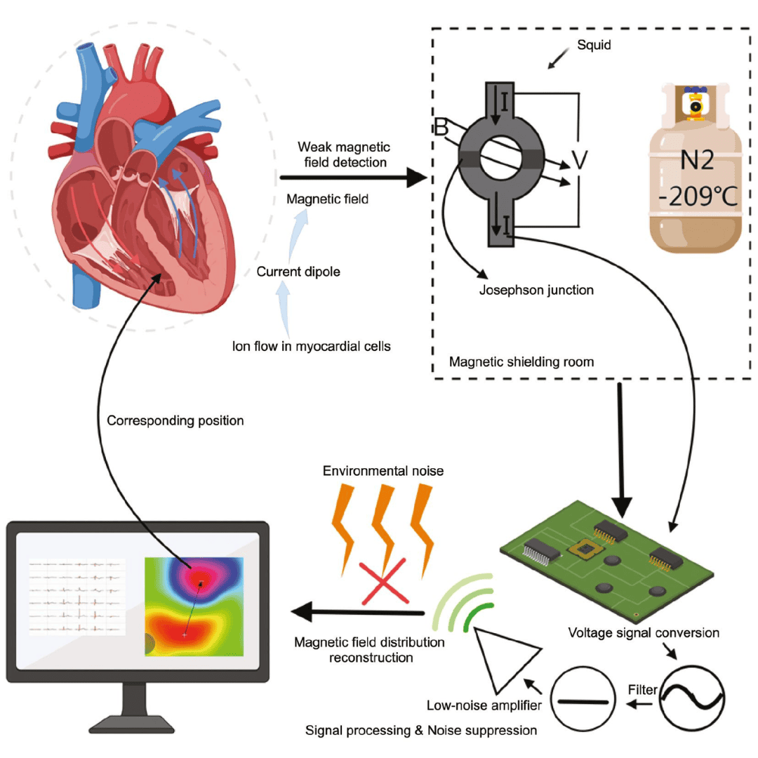 Clinical Applications of Magnetocardiography in Cardiovascular Medicine: Technological Advances, Challenges, and Future Perspectives