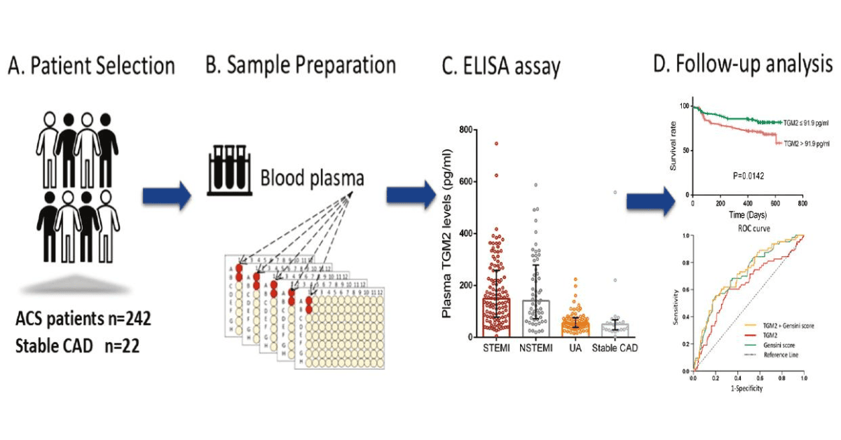 Circulating TGM2 Levels as a Prognostic Biomarker for Coronary Artery Disease Severity and Major Adverse Cardiac Events in Acute Coronary Syndrome