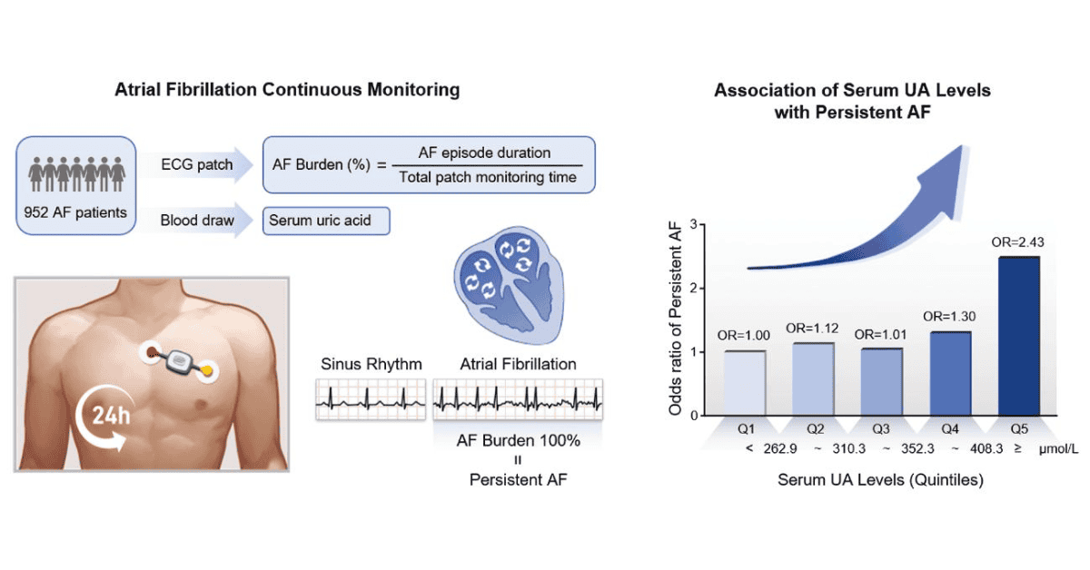 Association Between Serum Uric Acid Levels and Atrial Fibrillation Burden