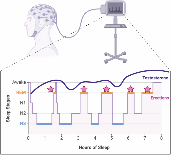 The role of sleep stages in the regulation of erectile function: impacts of REM sleep fragmentation