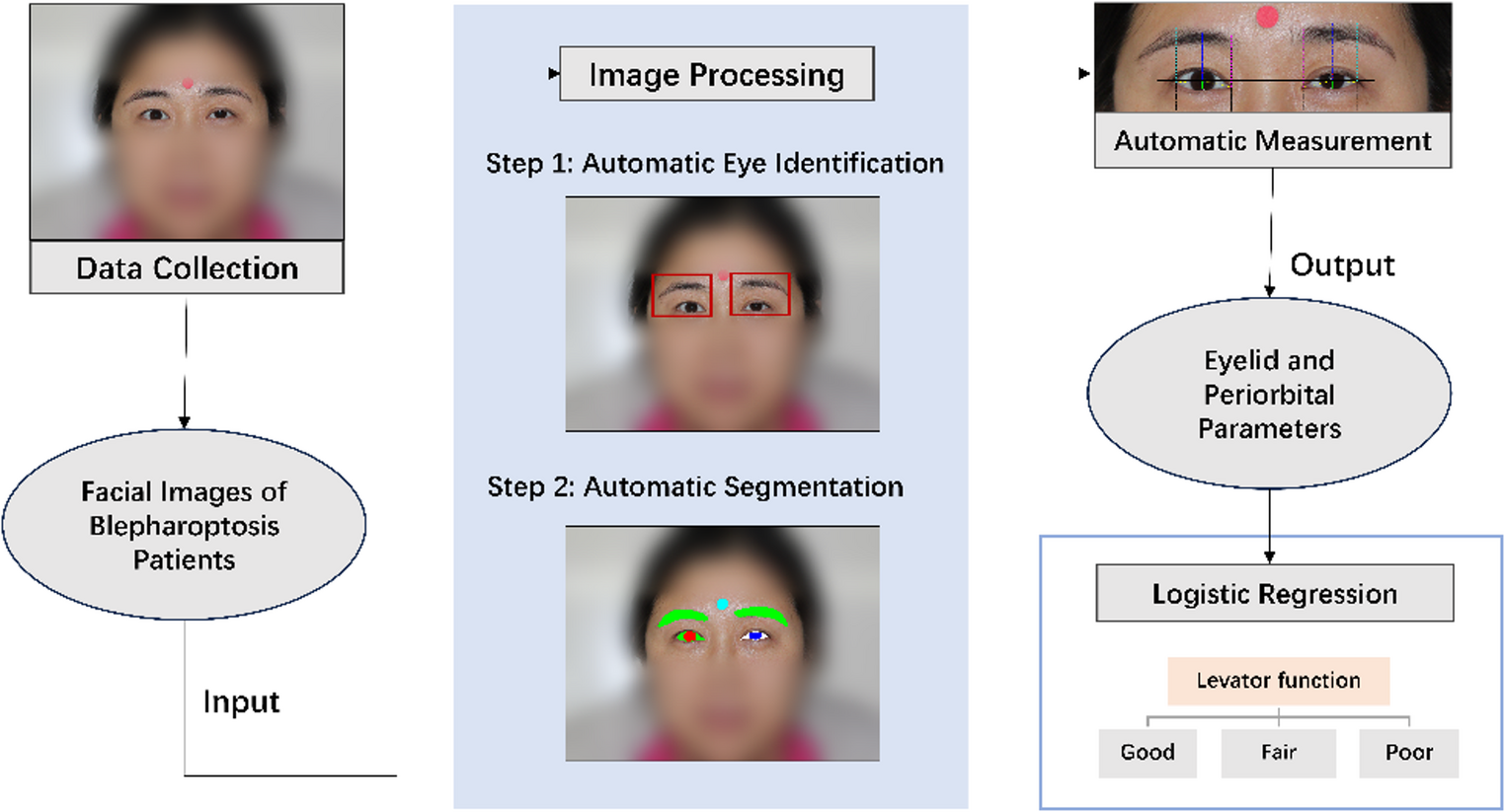 Deep Learning-based Assessment of Eyelid and Periorbital Parameters: Assisting Diagnosis and Treatment Planning in Blepharoptosis