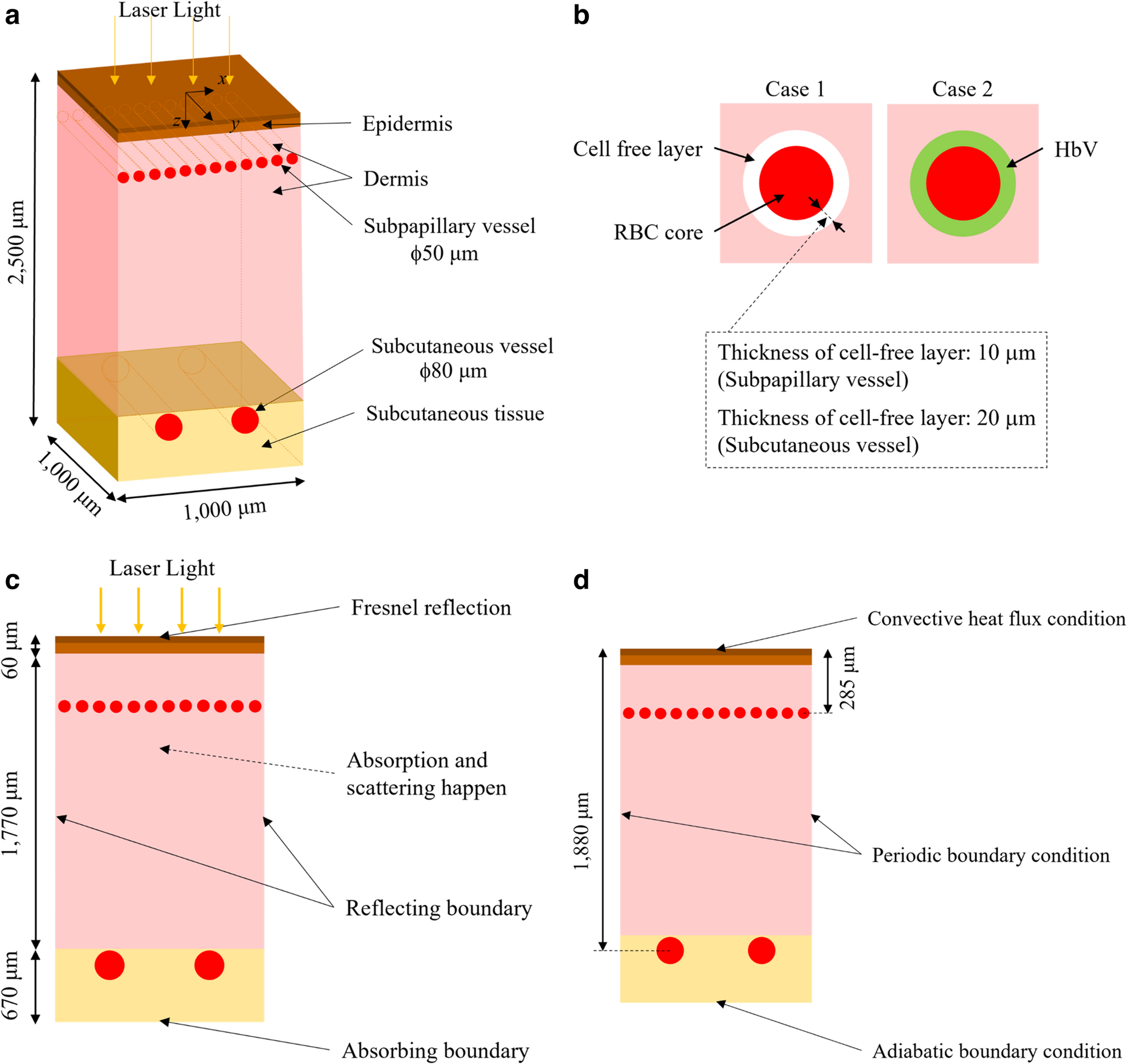 A numerical study on the effect of laser therapy against port-wine stain by administering artificial red blood cells