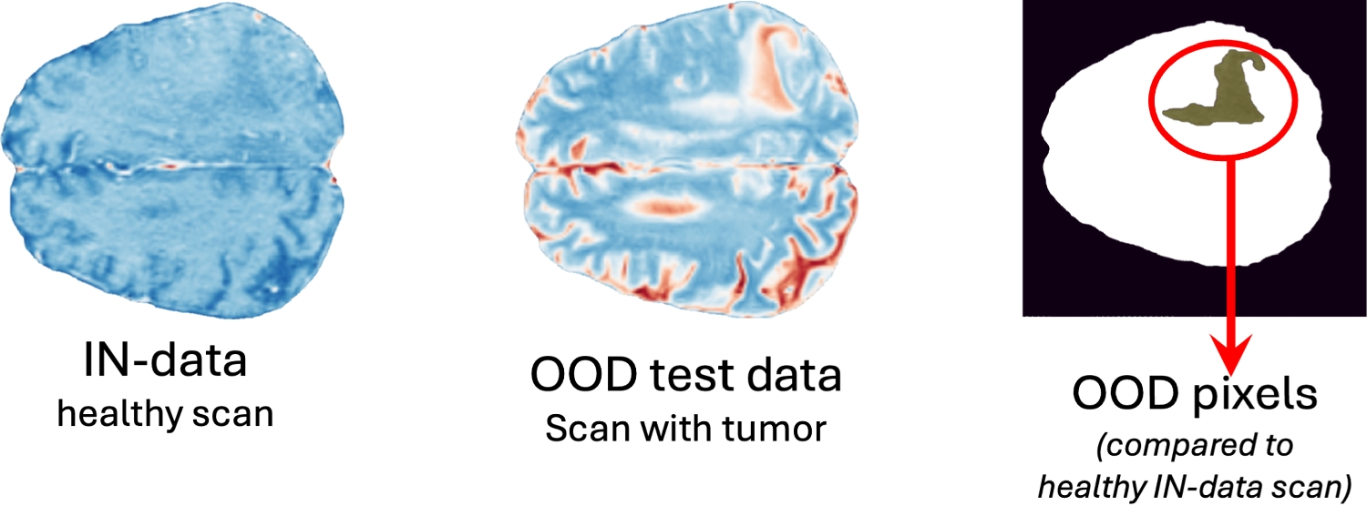Out-of-Distribution Detection in Medical Image Segmentation with $$\beta $$-VAE and Likelihood Regret
