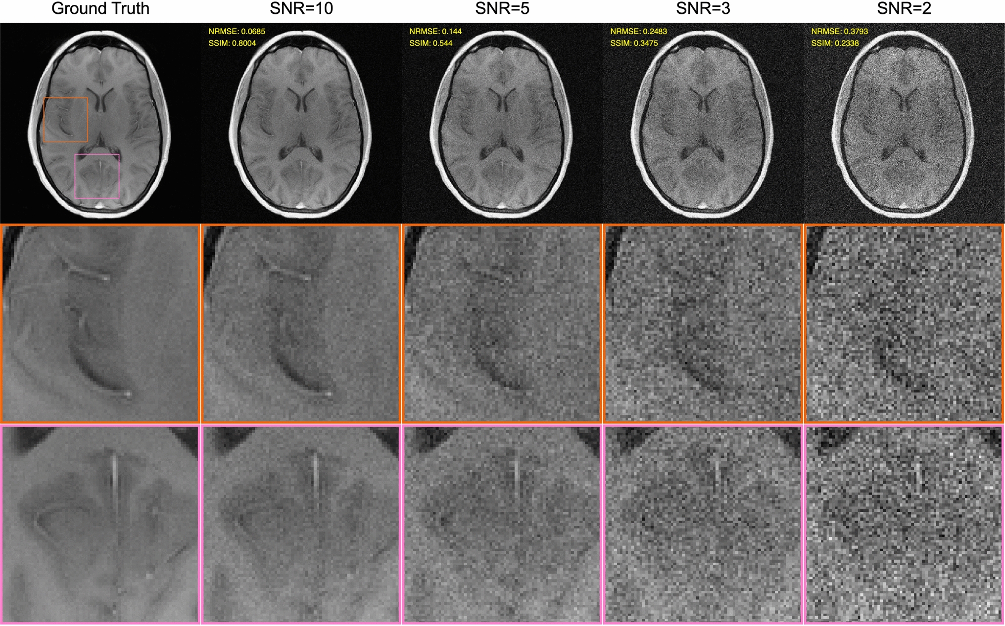 Well-designed k-space coverage is important for good MRI denoising