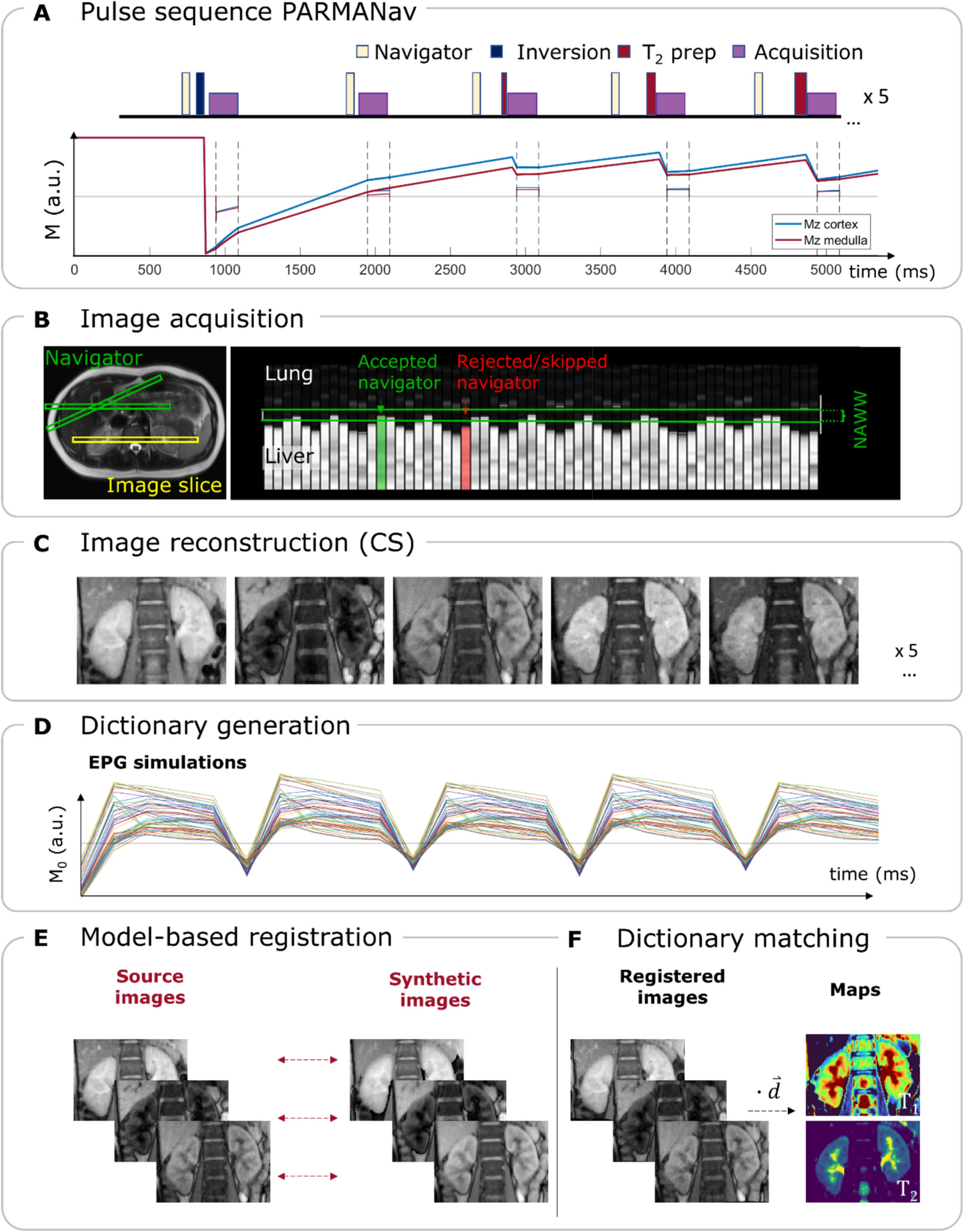 Navigator-gated free-breathing joint T–T mapping of the kidney