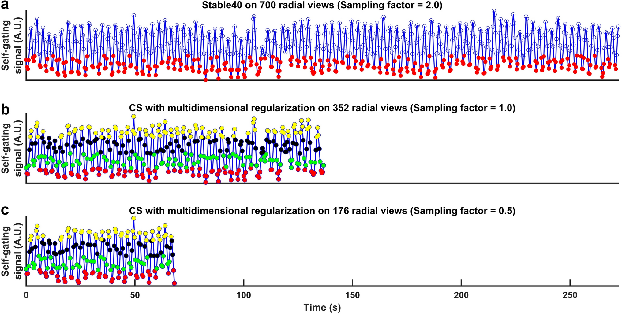 Accelerated free-breathing volumetric liver proton density fat fraction (PDFF) and $${\mathbf{R}}_{2}^{\mathbf{*}}$$ quantification in pediatric patients using stack-of-radial MRI with multidimensional regularized reconstruction: a retrospective study