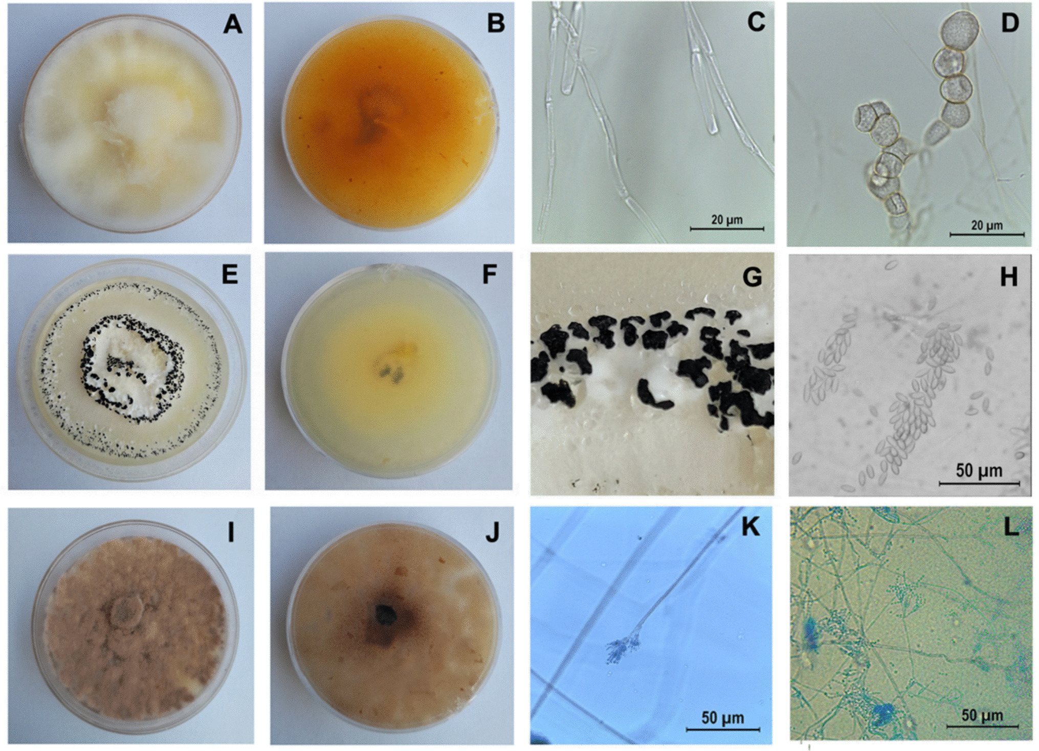 Isolation, Identification, and Pathogenicity of Entomopathogenic Fungal Strains and Their Secondary Metabolites Against  (Lepidoptera: Noctuidae)
