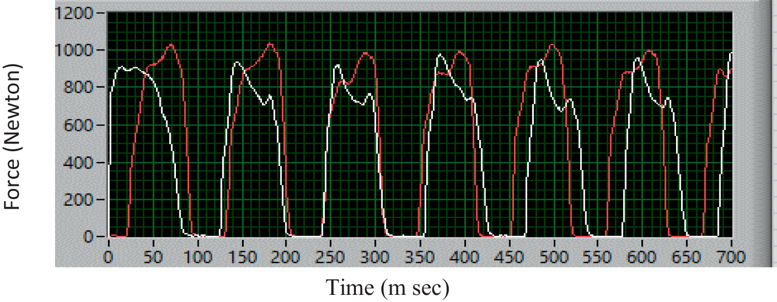 Variations in gait patterns in women and men with Parkinson’s disease