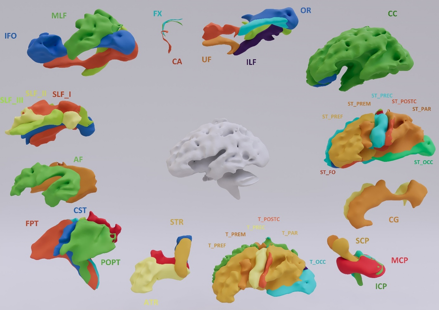 Application of Fully Convolutional Neural Networks in the Assessment of Cerebral White Matter Involvement in Primary Sjögren’s Syndrome